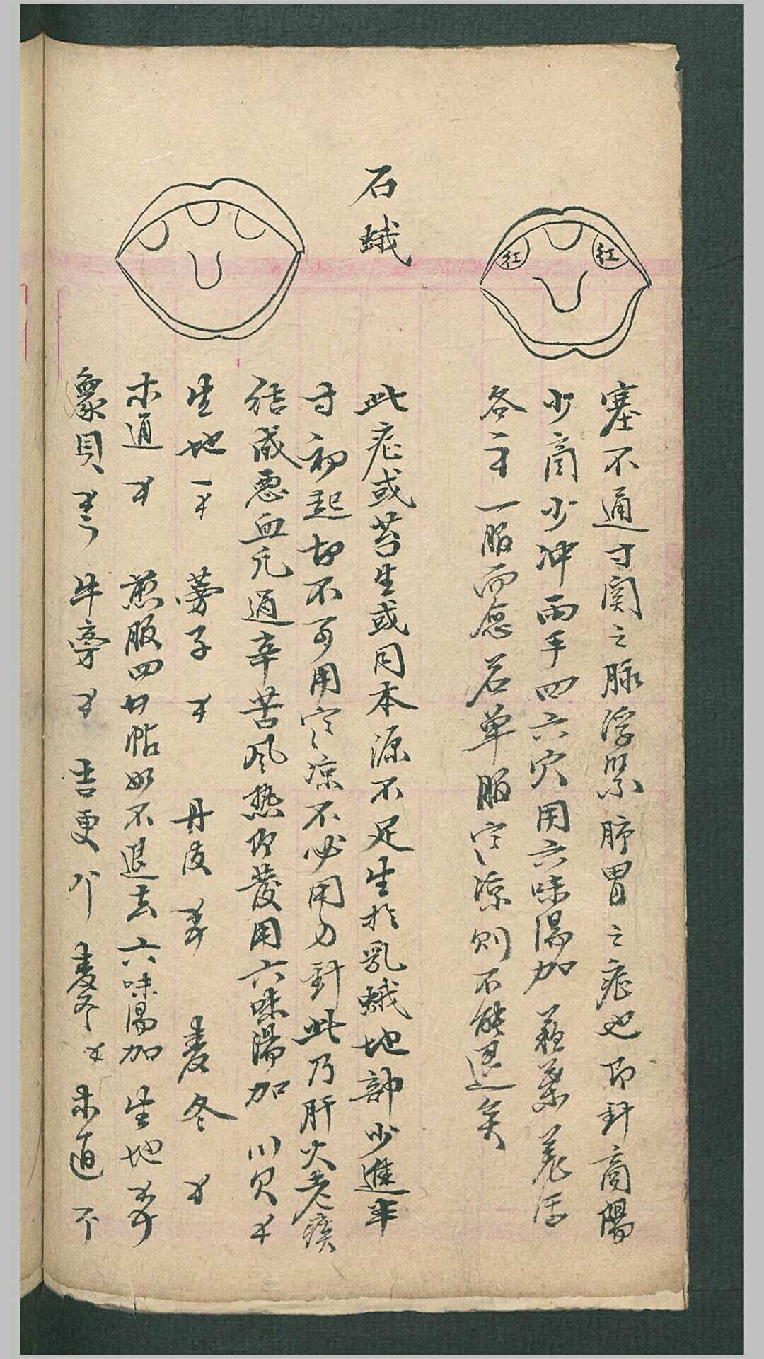 图片[4]-中华古籍网-专注古书收集喉症便览-中华古籍网-专注古书收集中华古籍网-专注古书收集