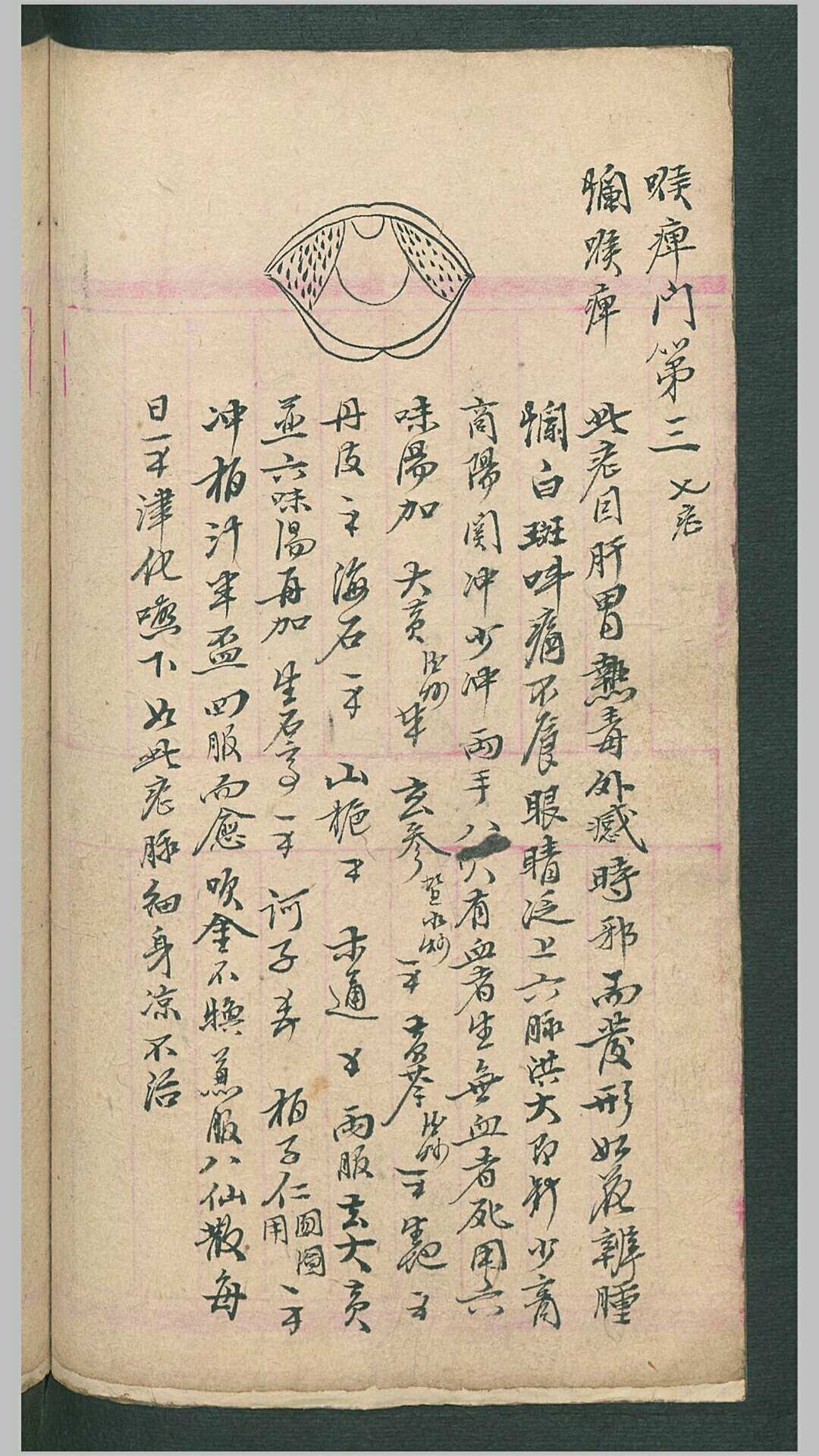 图片[5]-中华古籍网-专注古书收集喉症便览-中华古籍网-专注古书收集中华古籍网-专注古书收集