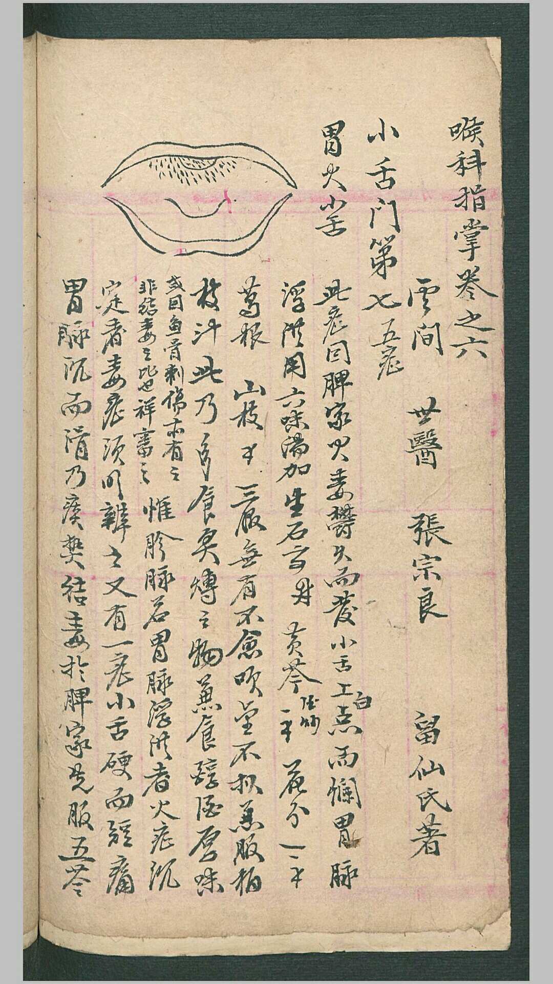 图片[6]-中华古籍网-专注古书收集喉症便览-中华古籍网-专注古书收集中华古籍网-专注古书收集