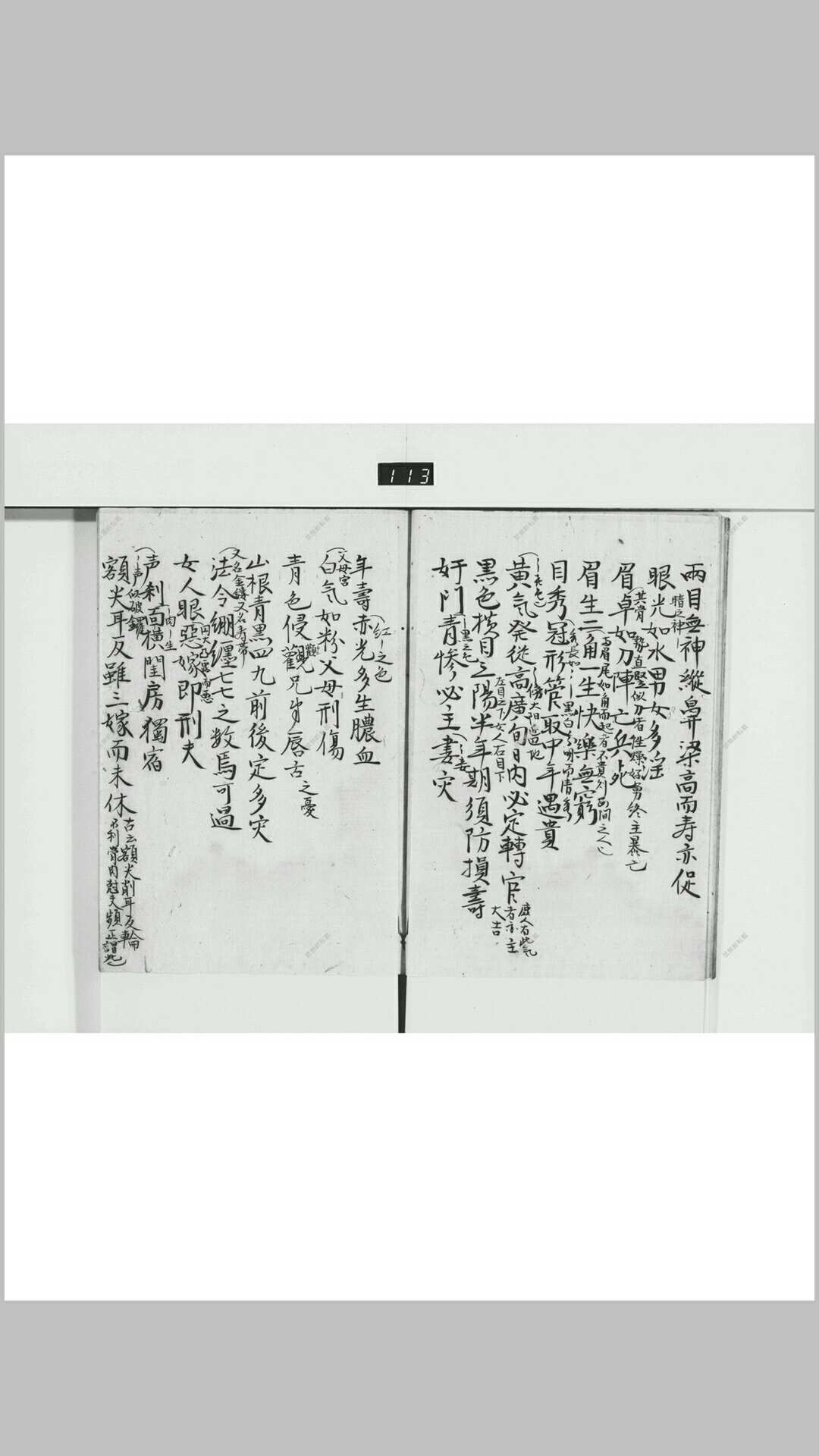 图片[8]-中华古籍网-专注古书收集麻衣相神异赋-中华古籍网-专注古书收集中华古籍网-专注古书收集