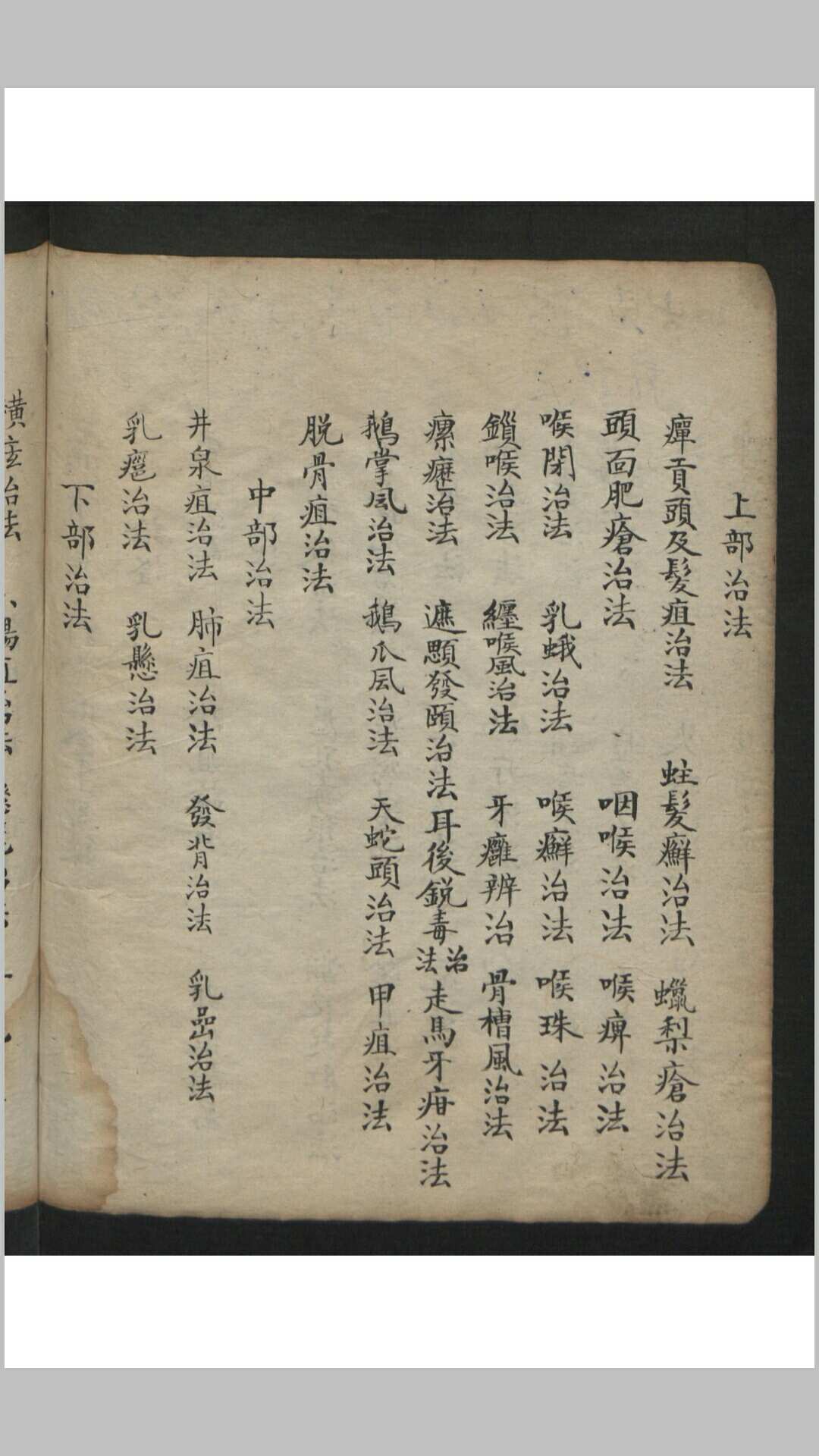 图片[10]-中华古籍网-专注古书收集王维德 罗湖 外科证治全生集 , 1886-中华古籍网-专注古书收集中华古籍网-专注古书收集