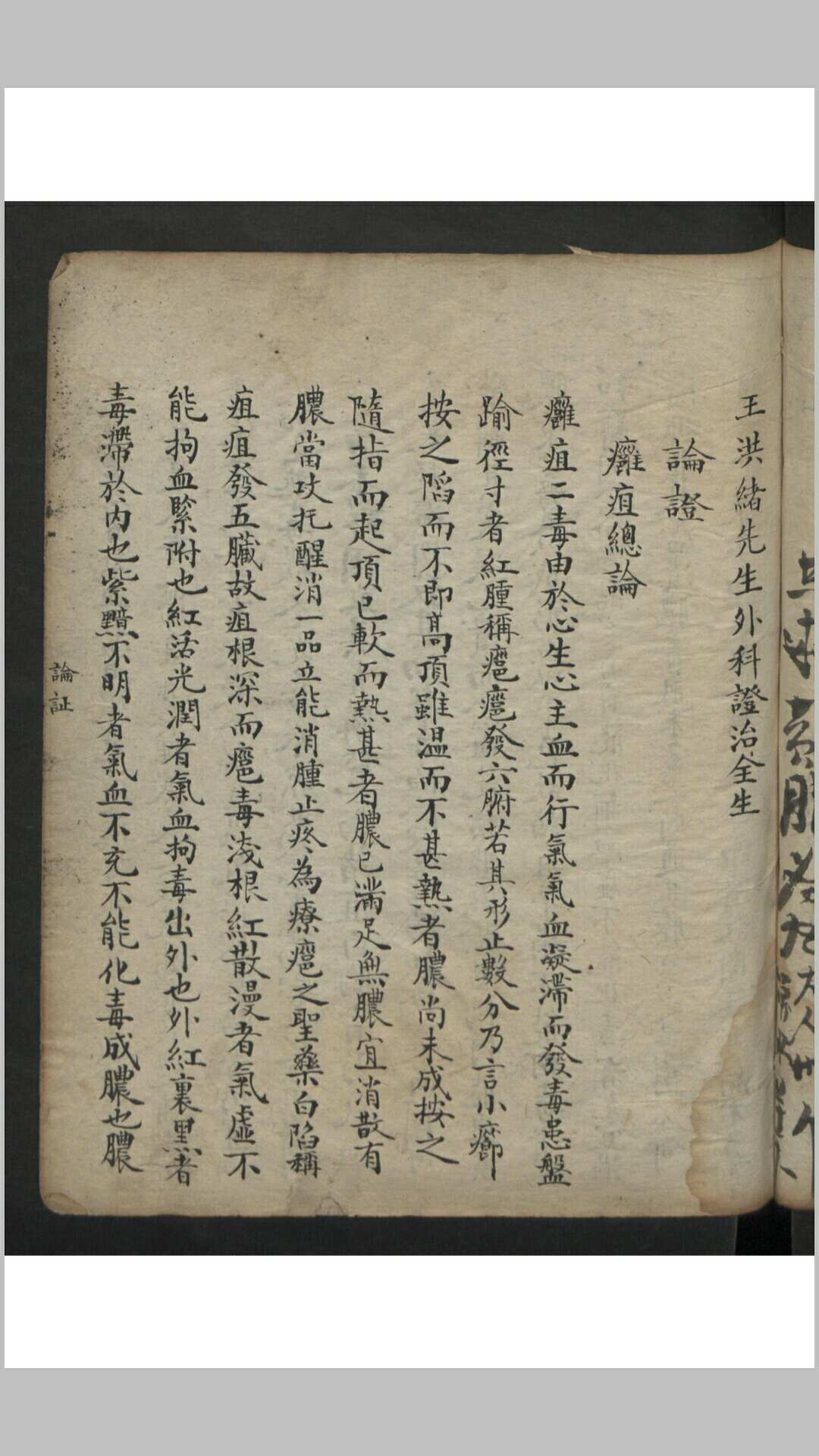 图片[11]-中华古籍网-专注古书收集王维德 罗湖 外科证治全生集 , 1886-中华古籍网-专注古书收集中华古籍网-专注古书收集
