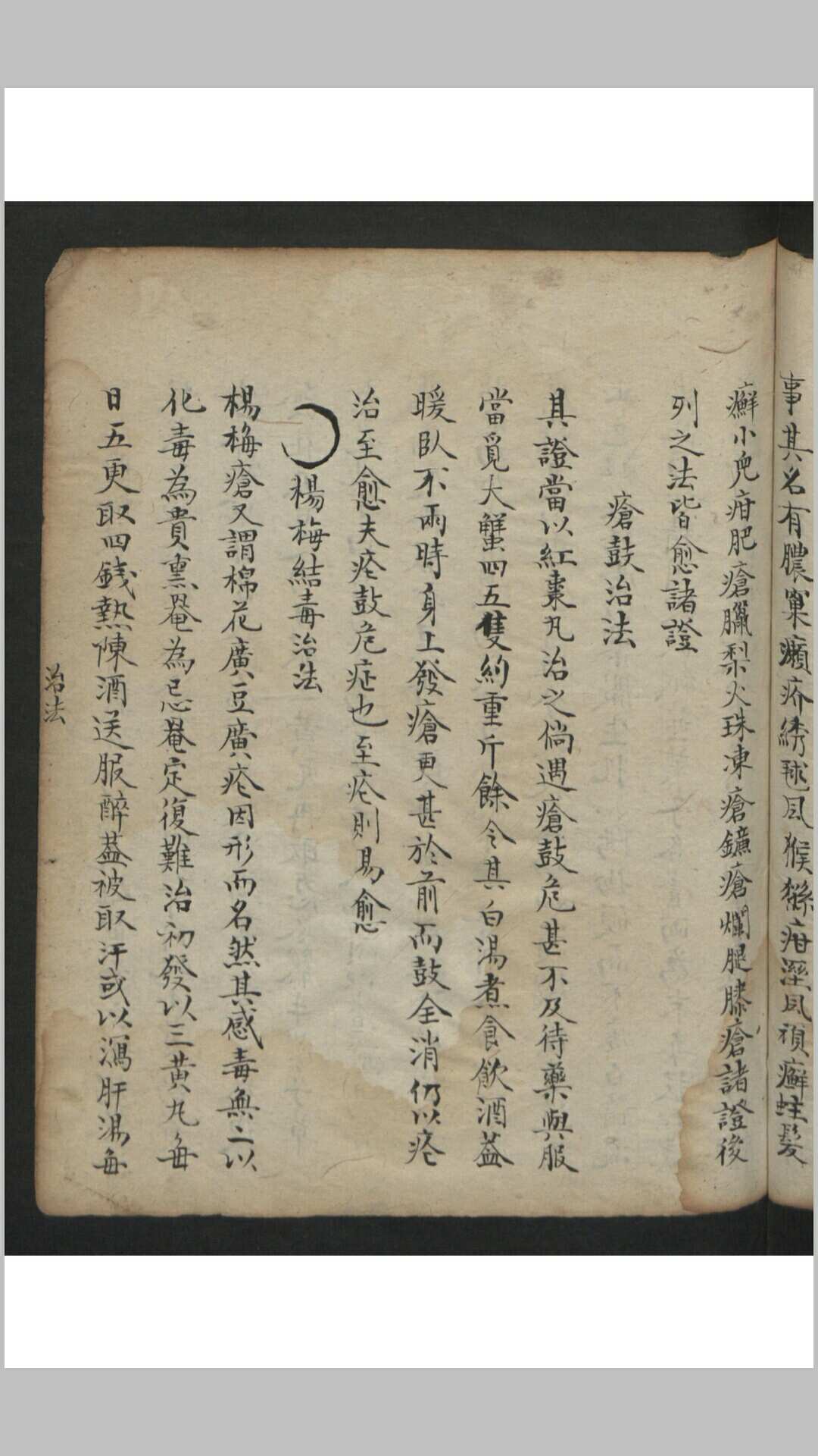 图片[12]-中华古籍网-专注古书收集王维德 罗湖 外科证治全生集 , 1886-中华古籍网-专注古书收集中华古籍网-专注古书收集