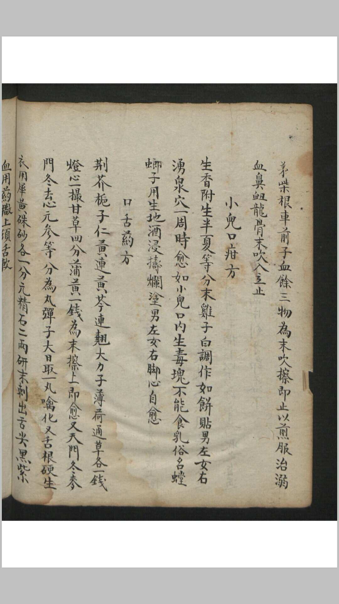 图片[13]-中华古籍网-专注古书收集王维德 罗湖 外科证治全生集 , 1886-中华古籍网-专注古书收集中华古籍网-专注古书收集