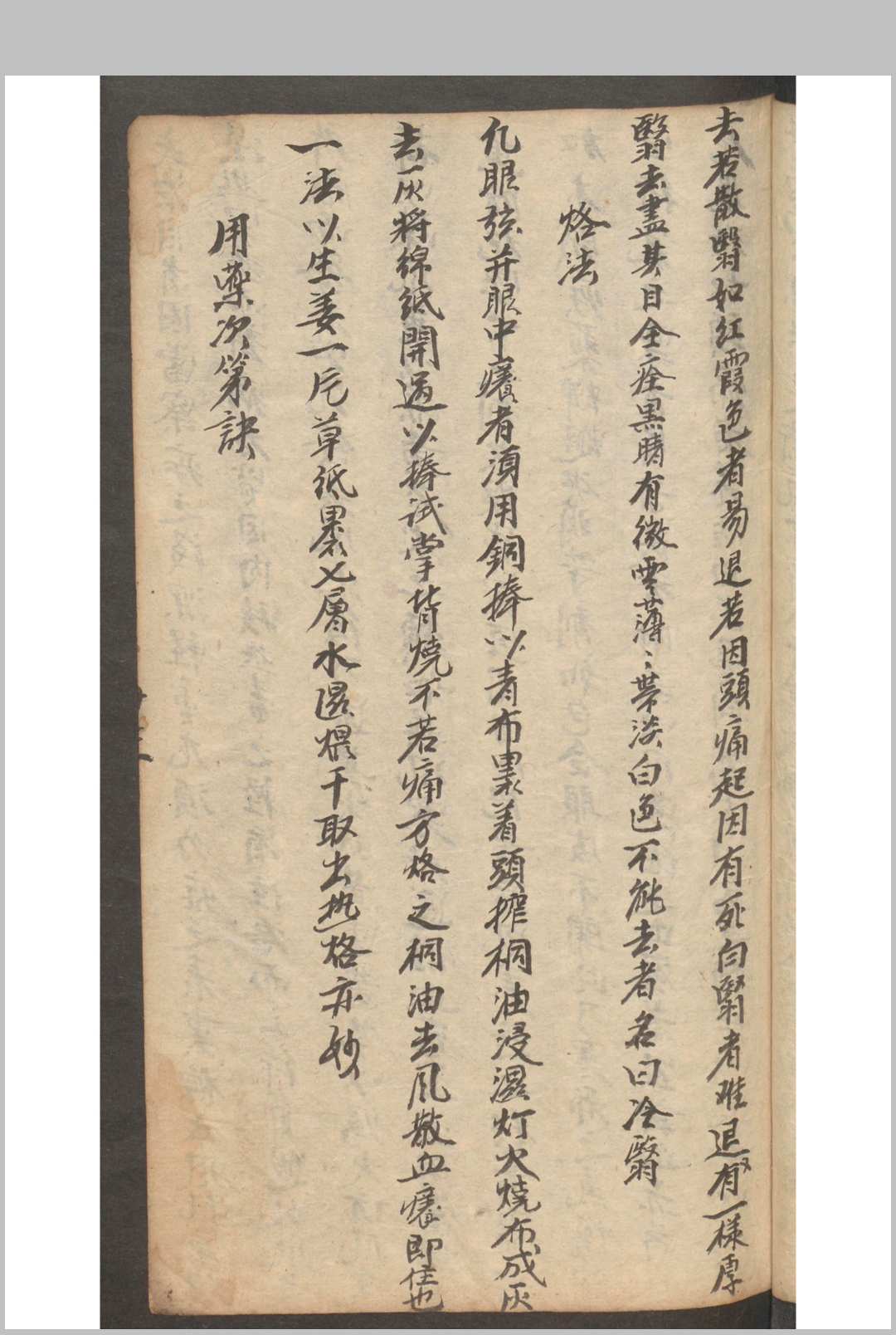 图片[4]-中华古籍网-专注古书收集秘传眼科髓-中华古籍网-专注古书收集中华古籍网-专注古书收集