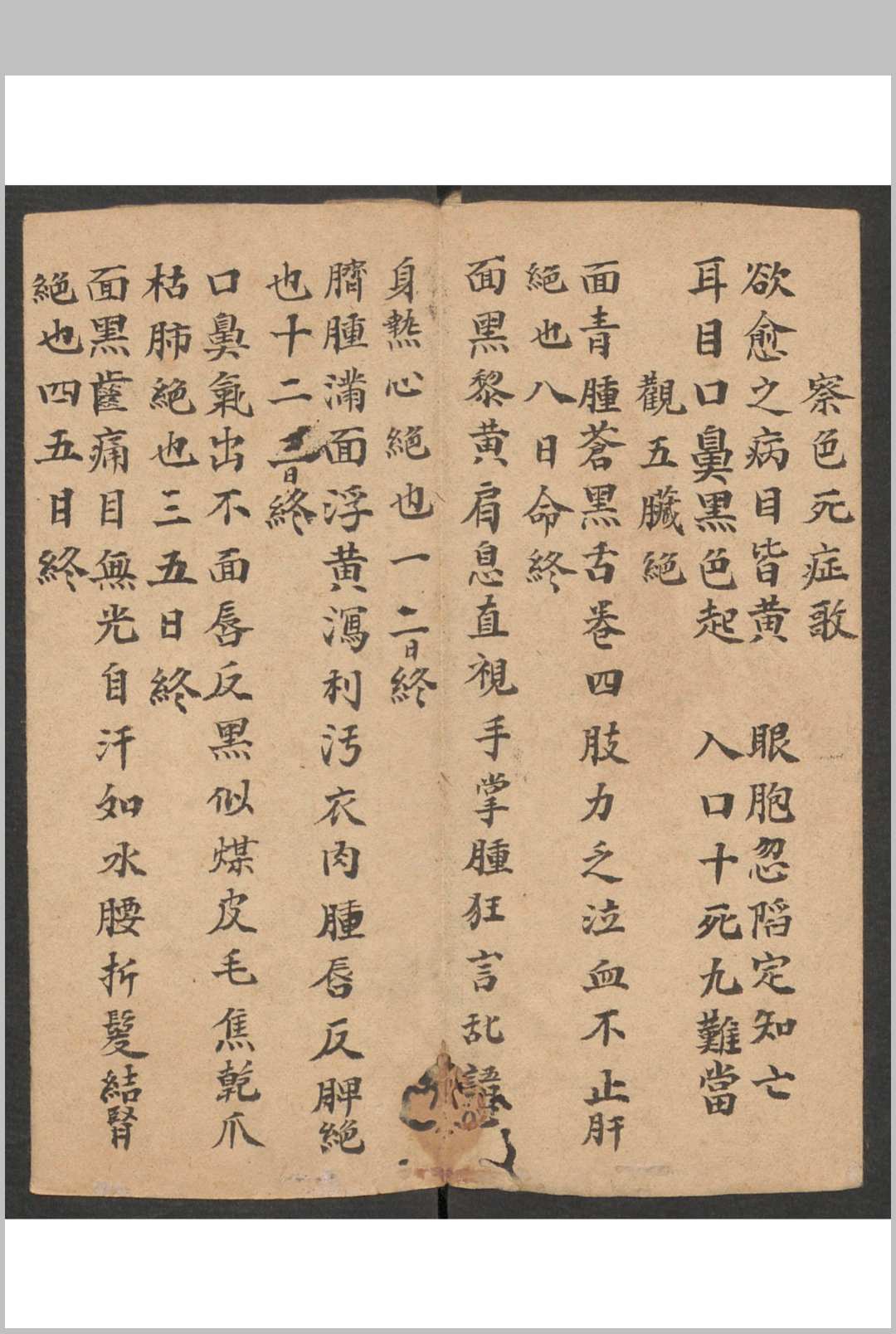图片[2]-中华古籍网-专注古书收集诊法杂抄, 1800-中华古籍网-专注古书收集中华古籍网-专注古书收集