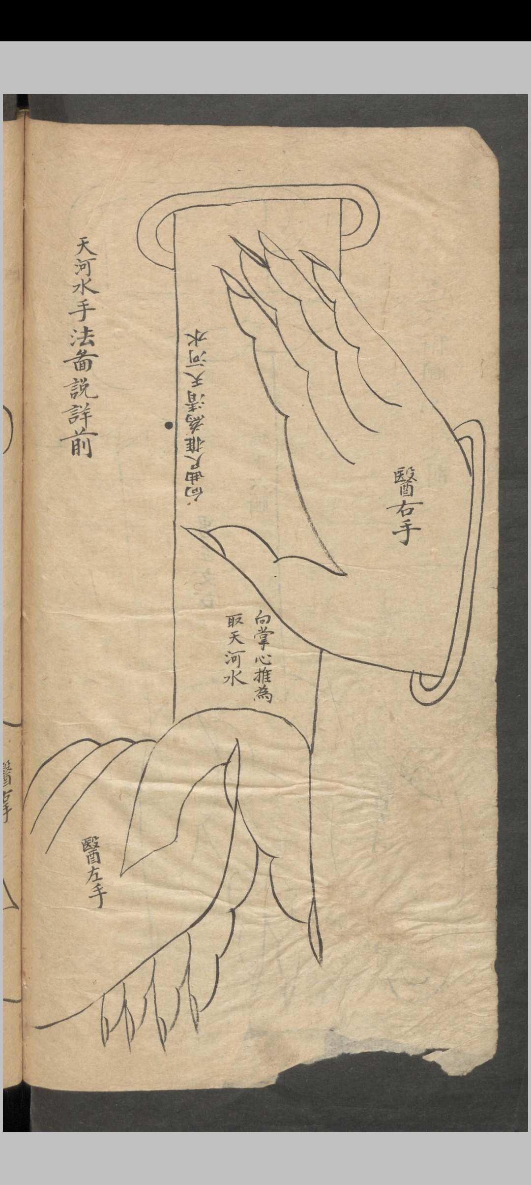 图片[17]-中华古籍网-专注古书收集推拿小儿科-中华古籍网-专注古书收集中华古籍网-专注古书收集