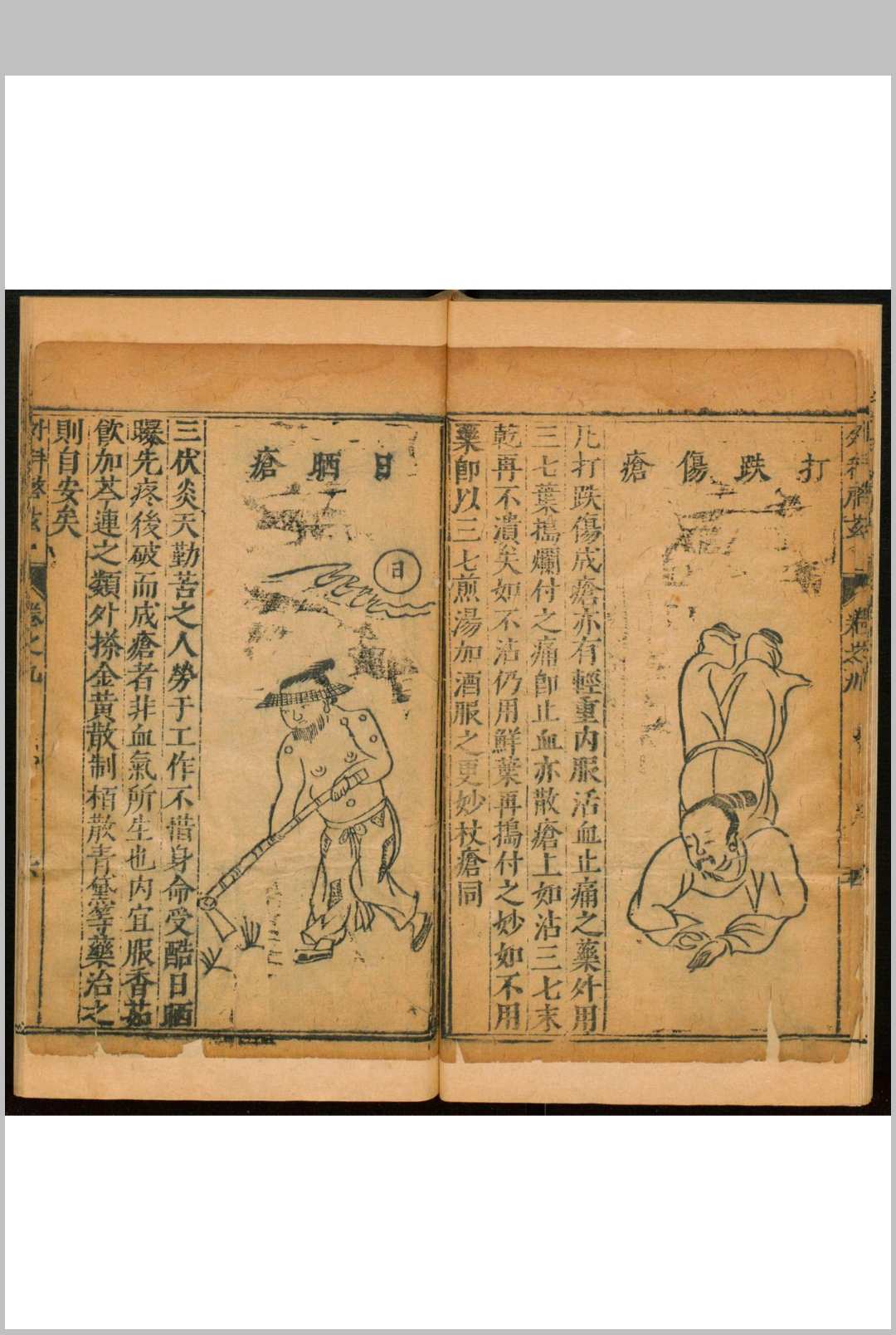 图片[13]中华古籍网-专注古书收集申斗垣校正外科启玄  十二卷中华古籍网-专注古书收集中华古籍网
