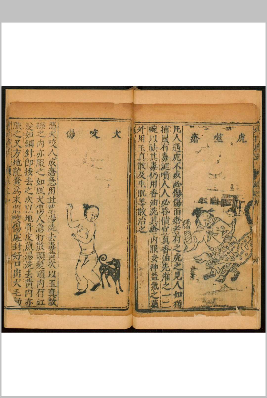 图片[11]中华古籍网-专注古书收集申斗垣校正外科启玄  十二卷中华古籍网-专注古书收集中华古籍网
