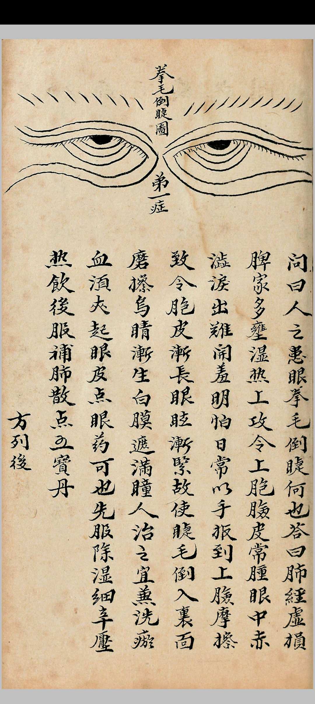 图片[7]-中华古籍网-专注古书收集龙宫真秘眼科-中华古籍网-专注古书收集中华古籍网-专注古书收集