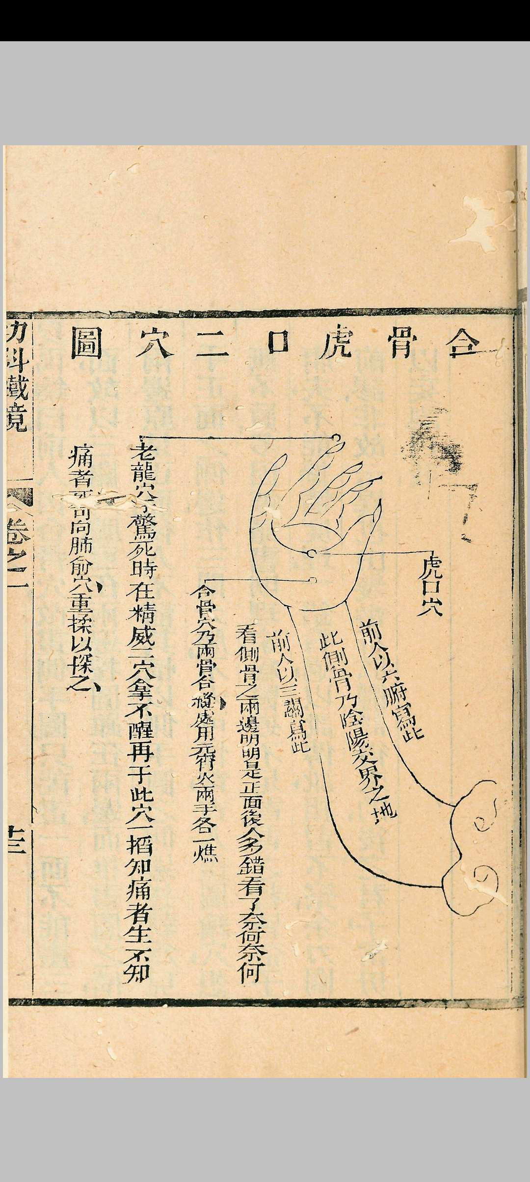 图片[9]中华古籍网-专注古书收集幼科铁镜 六卷中华古籍网-专注古书收集中华古籍网
