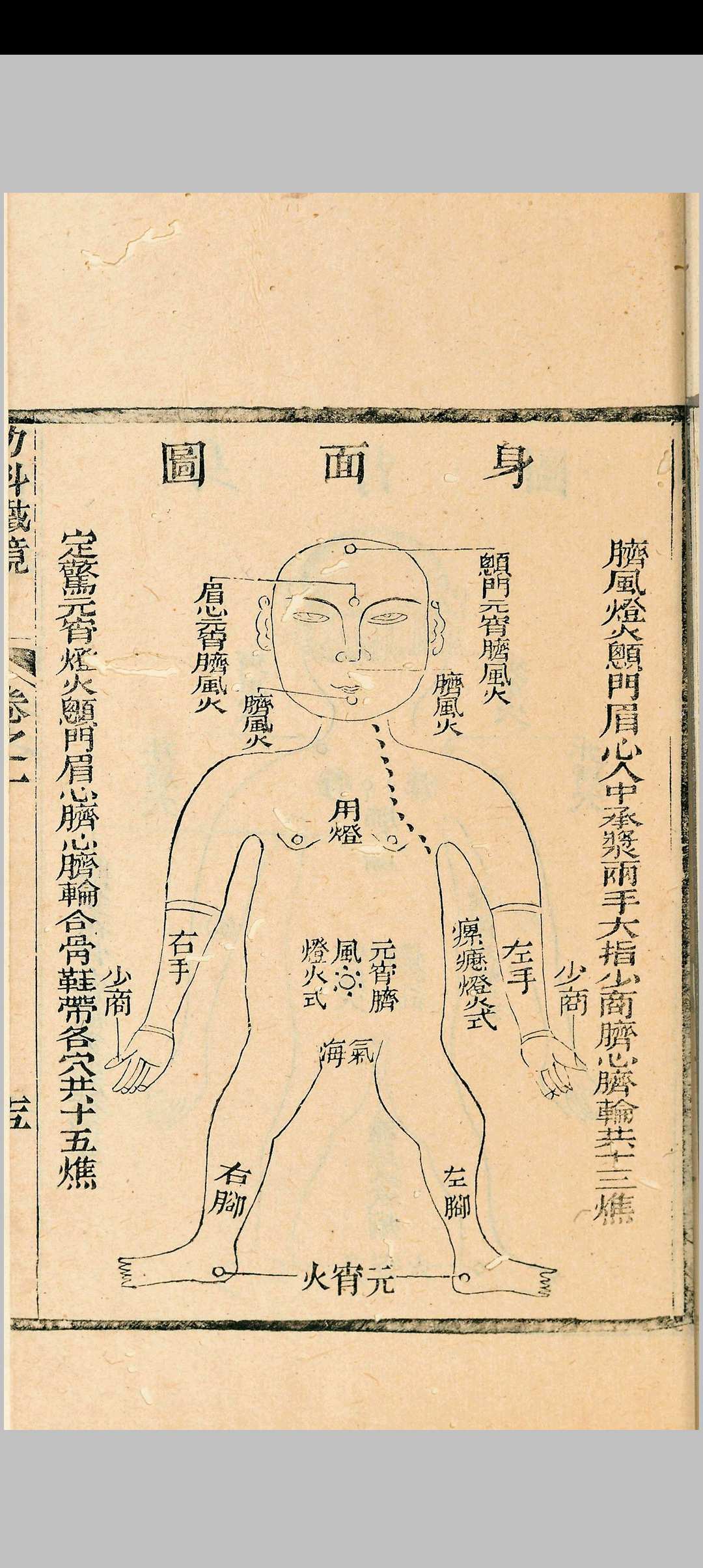 图片[8]中华古籍网-专注古书收集幼科铁镜 六卷中华古籍网-专注古书收集中华古籍网