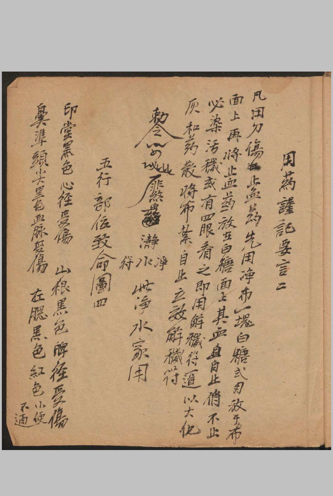 图片[11]-中华古籍网-专注古书收集跌扑损伤-中华古籍网-专注古书收集中华古籍网-专注古书收集