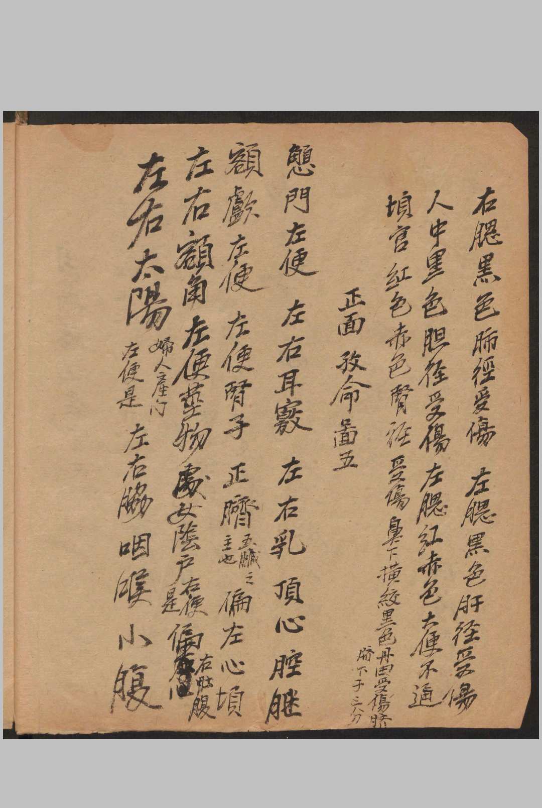 图片[4]-中华古籍网-专注古书收集跌扑损伤-中华古籍网-专注古书收集中华古籍网-专注古书收集