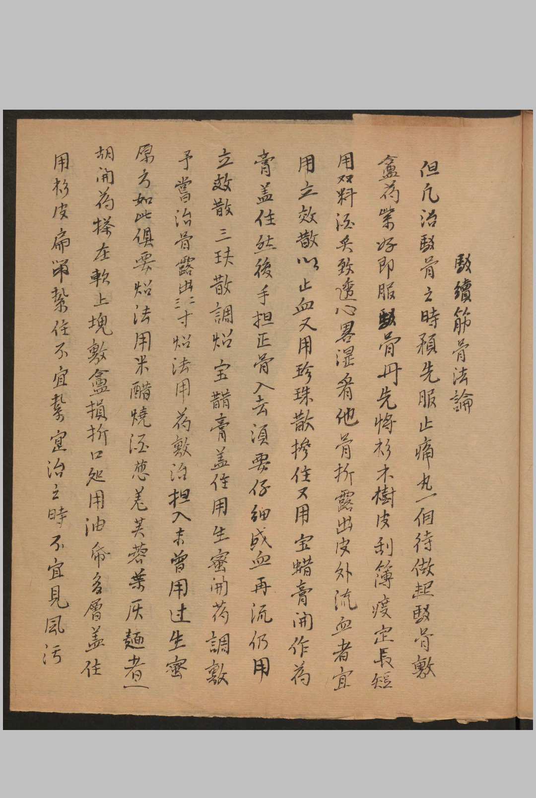图片[9]-中华古籍网-专注古书收集跌扑损伤-中华古籍网-专注古书收集中华古籍网-专注古书收集