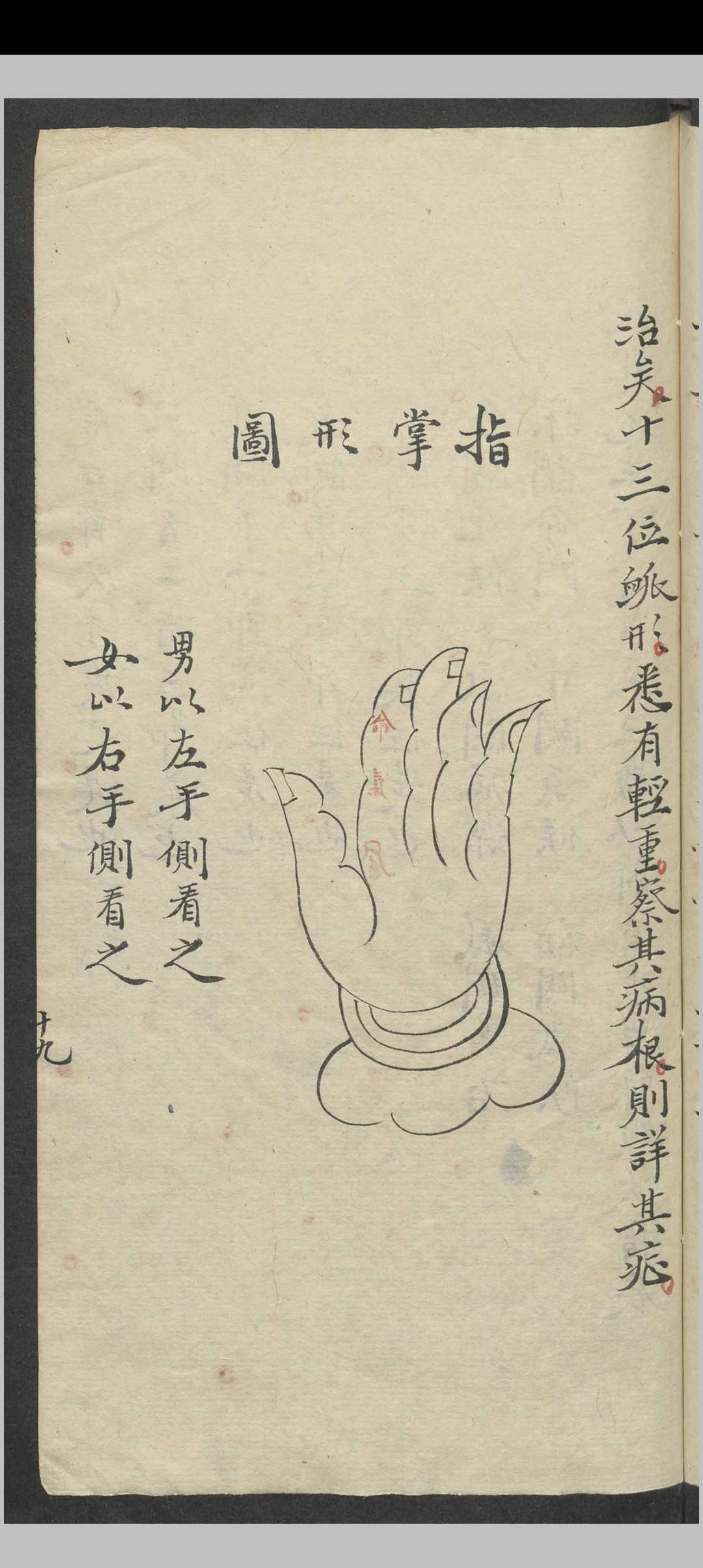 图片[12]-中华古籍网-专注古书收集万全 万氏秘传片玉心书   1900-中华古籍网-专注古书收集中华古籍网-专注古书收集