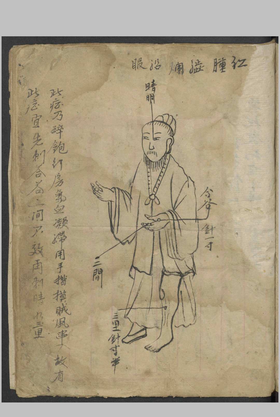 图片[3]-中华古籍网-专注古书收集绘图眼科秘方   1900-中华古籍网-专注古书收集中华古籍网-专注古书收集