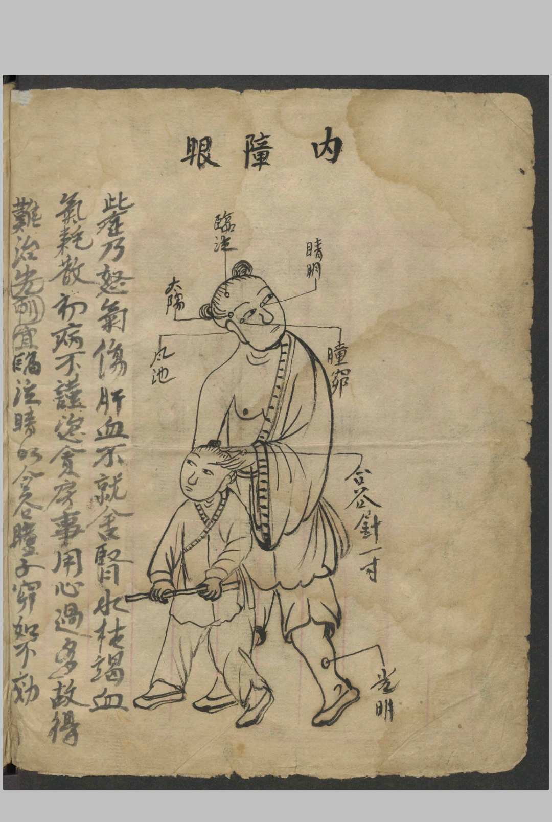 图片[2]-中华古籍网-专注古书收集绘图眼科秘方   1900-中华古籍网-专注古书收集中华古籍网-专注古书收集