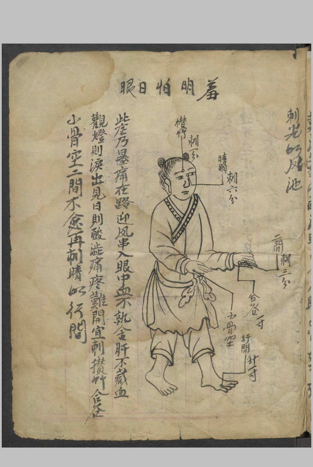 图片[4]-中华古籍网-专注古书收集绘图眼科秘方   1900-中华古籍网-专注古书收集中华古籍网-专注古书收集