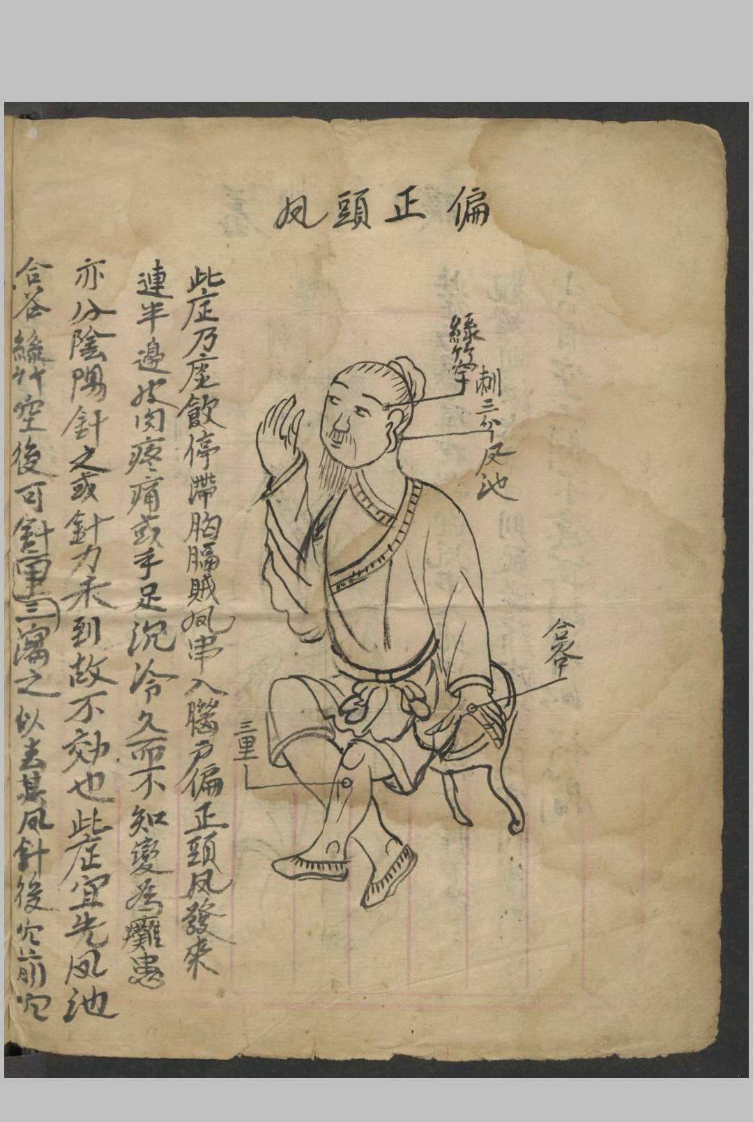 图片[6]-中华古籍网-专注古书收集绘图眼科秘方   1900-中华古籍网-专注古书收集中华古籍网-专注古书收集