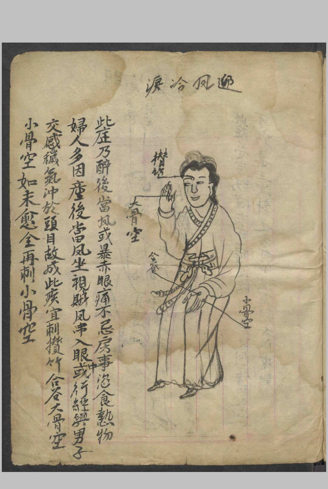 图片[7]-中华古籍网-专注古书收集绘图眼科秘方   1900-中华古籍网-专注古书收集中华古籍网-专注古书收集