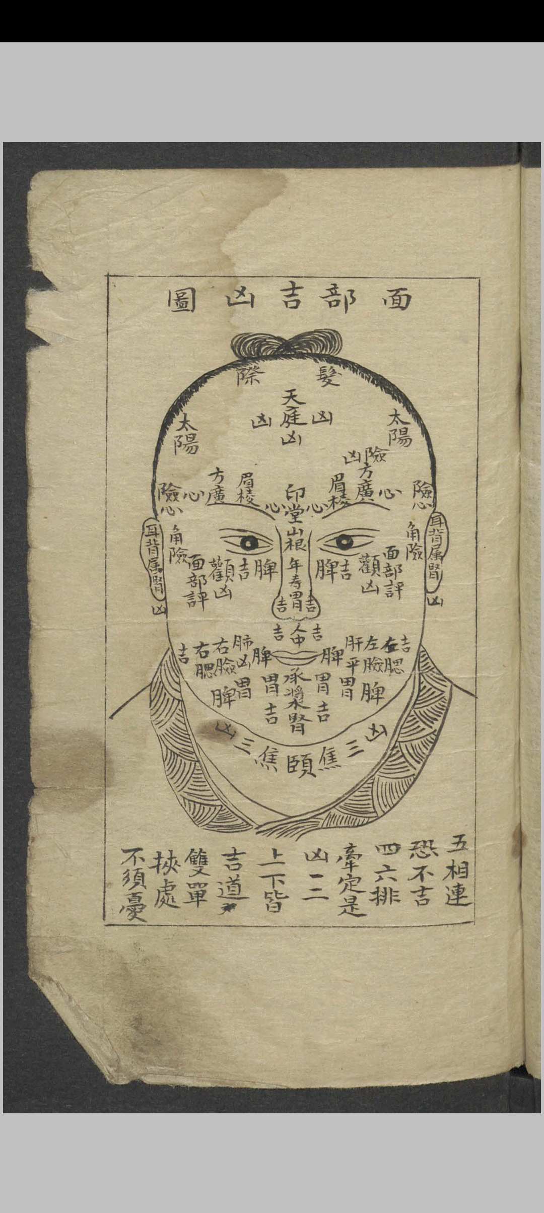 图片[2]-中华古籍网-专注古书收集外科摘要   民国23年  1934-中华古籍网-专注古书收集中华古籍网-专注古书收集