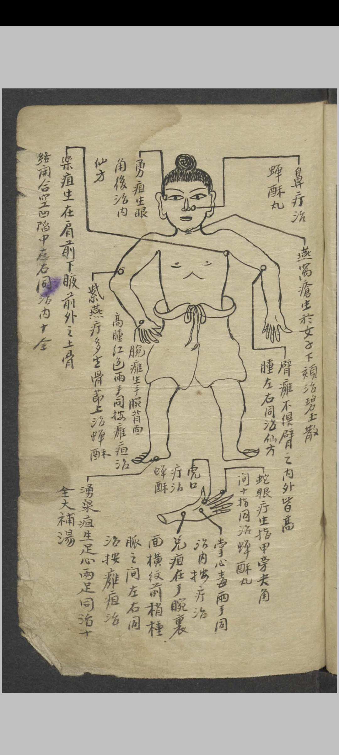 图片[3]-中华古籍网-专注古书收集外科摘要   民国23年  1934-中华古籍网-专注古书收集中华古籍网-专注古书收集
