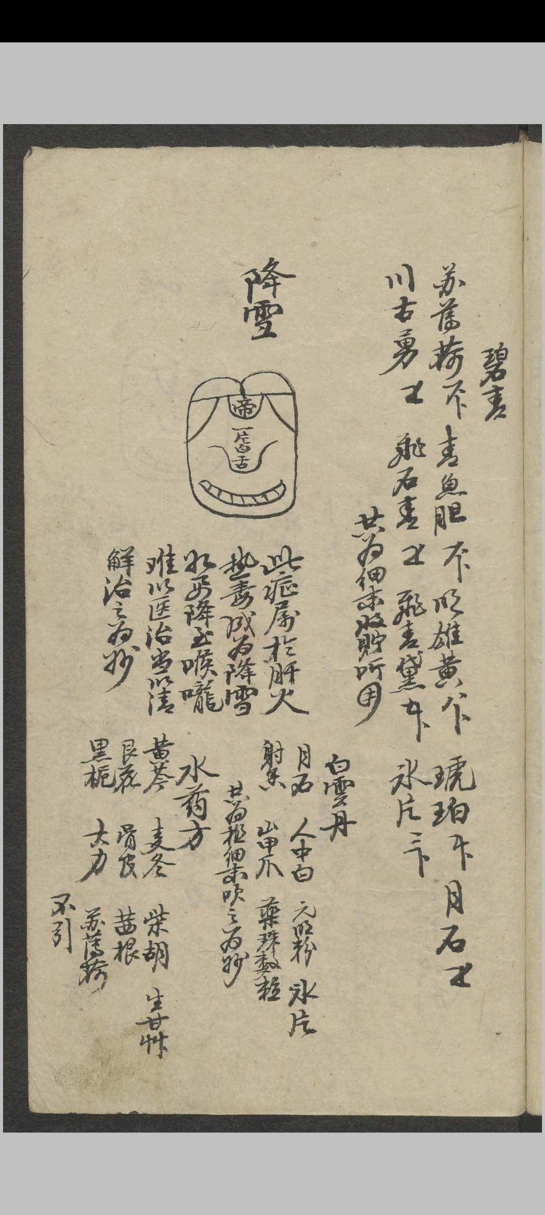 图片[4]-中华古籍网-专注古书收集郑宏绩 秘传喉科   1900-中华古籍网-专注古书收集中华古籍网-专注古书收集