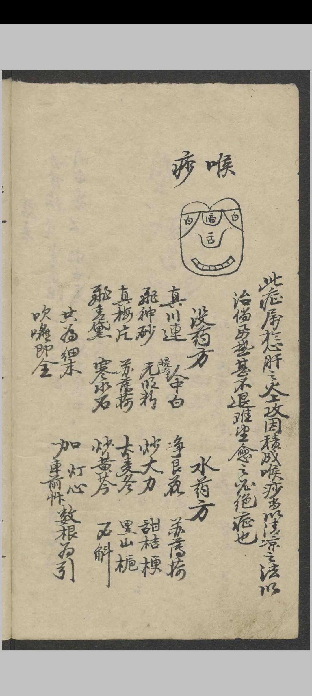图片[10]-中华古籍网-专注古书收集郑宏绩 秘传喉科   1900-中华古籍网-专注古书收集中华古籍网-专注古书收集