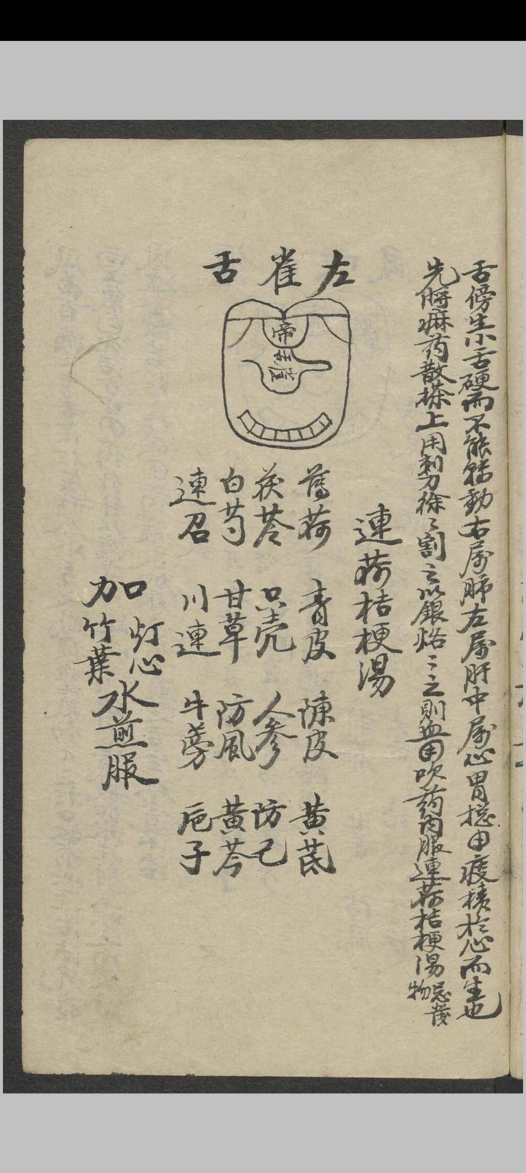 图片[11]-中华古籍网-专注古书收集郑宏绩 秘传喉科   1900-中华古籍网-专注古书收集中华古籍网-专注古书收集