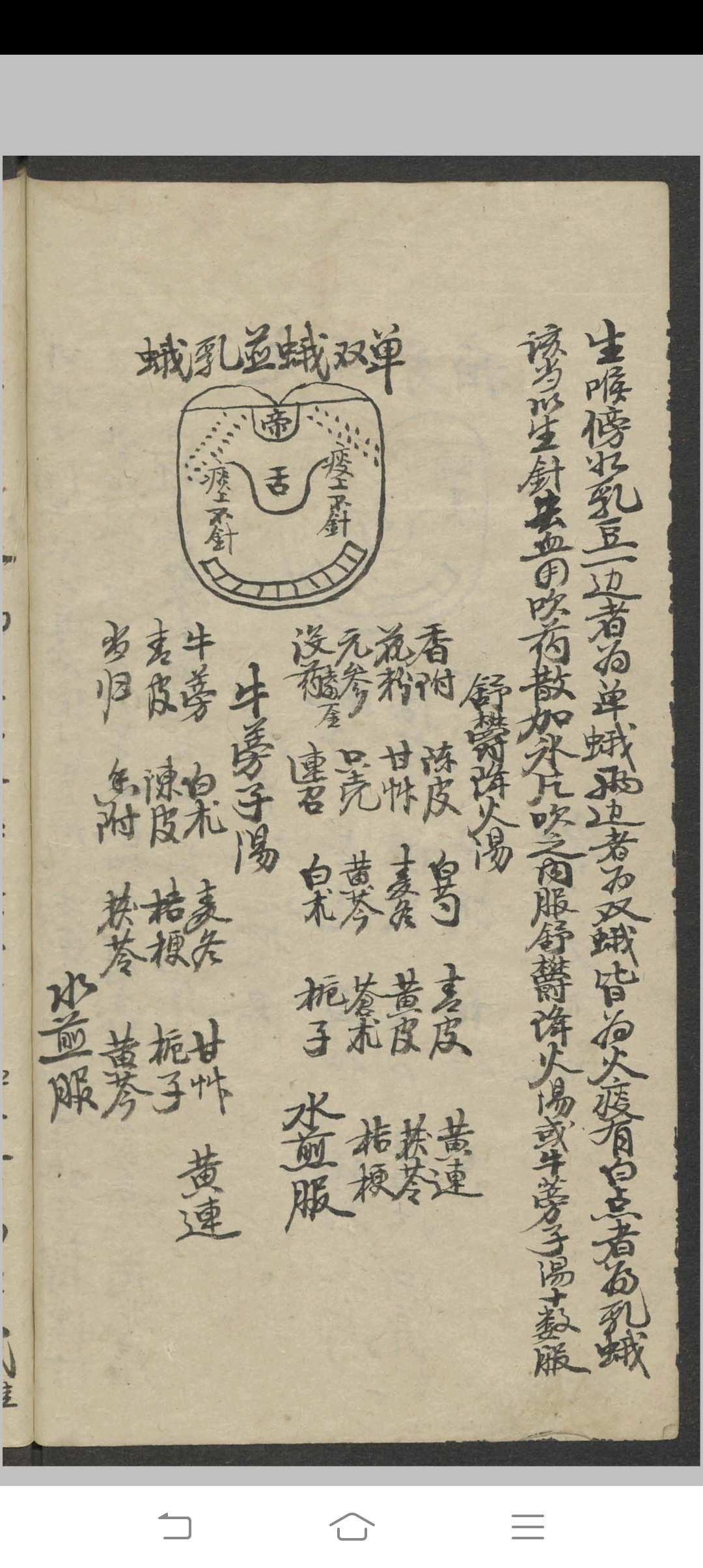 图片[8]-中华古籍网-专注古书收集郑宏绩 秘传喉科   1900-中华古籍网-专注古书收集中华古籍网-专注古书收集