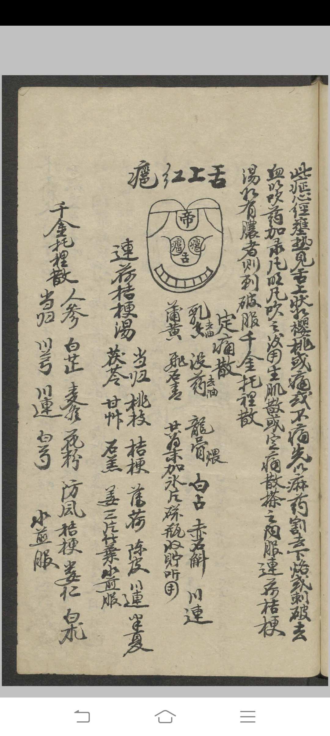 图片[7]-中华古籍网-专注古书收集郑宏绩 秘传喉科   1900-中华古籍网-专注古书收集中华古籍网-专注古书收集