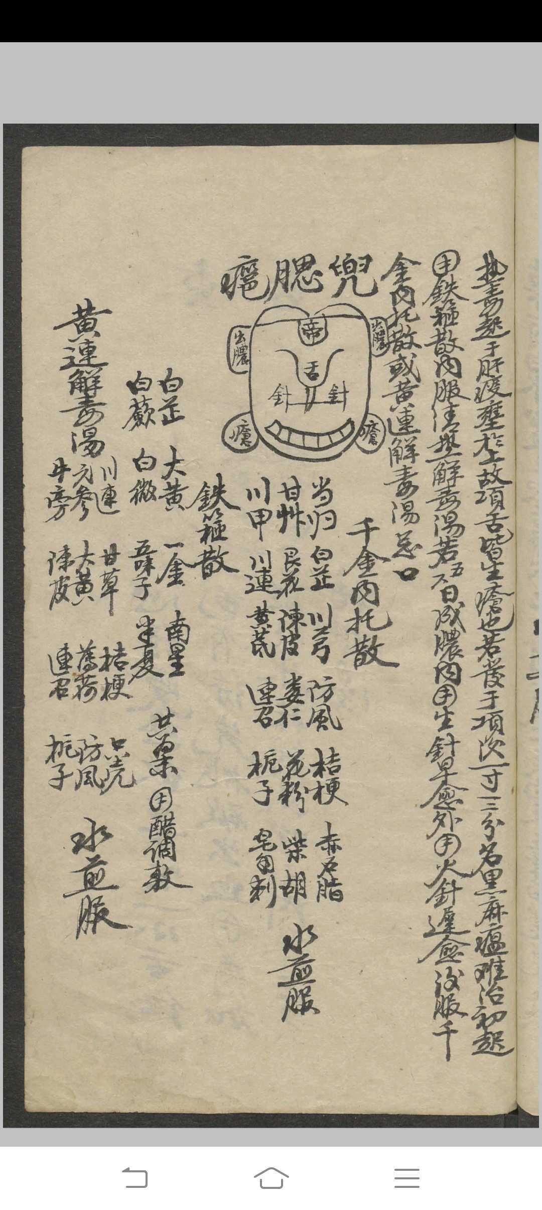 图片[6]-中华古籍网-专注古书收集郑宏绩 秘传喉科   1900-中华古籍网-专注古书收集中华古籍网-专注古书收集