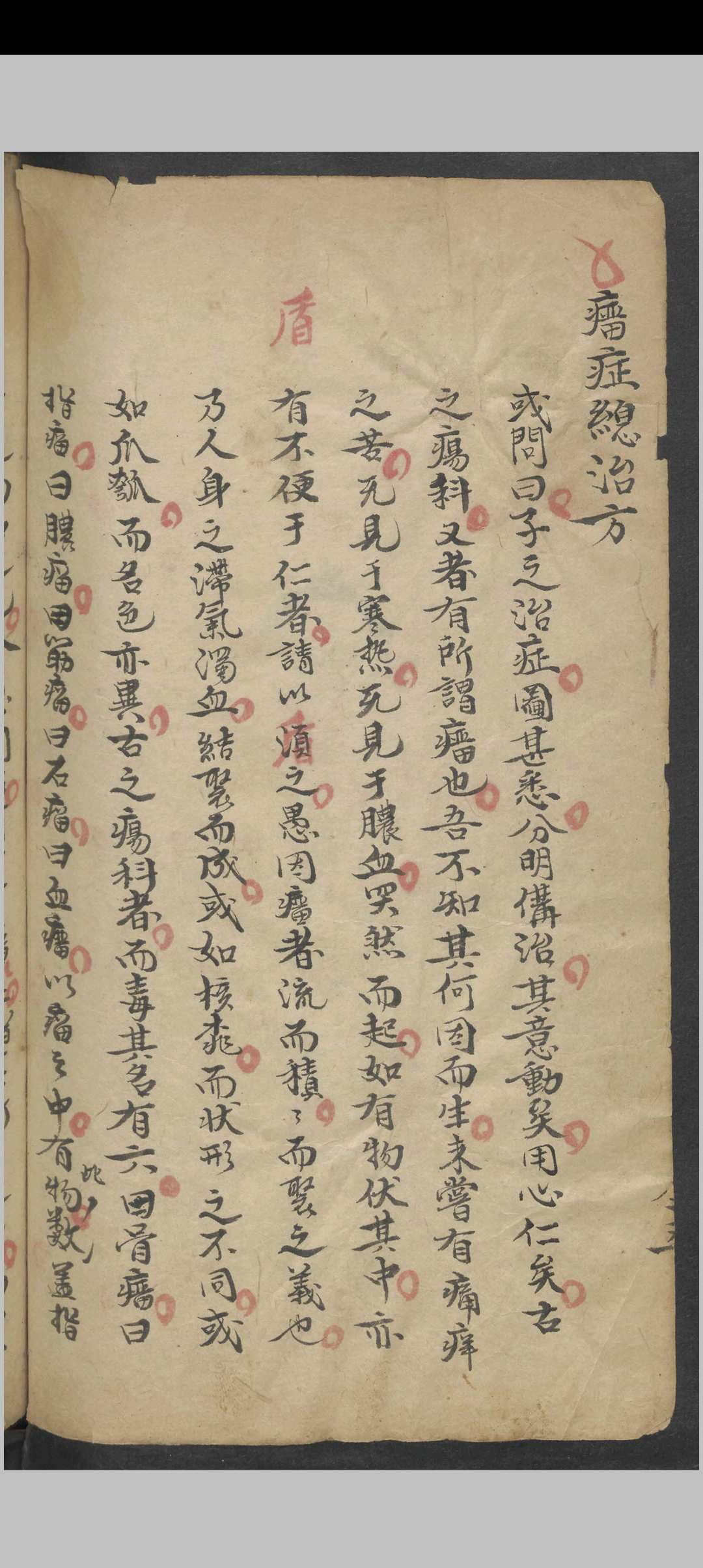 图片[5]-中华古籍网-专注古书收集外科图说及医方    1900-中华古籍网-专注古书收集中华古籍网-专注古书收集