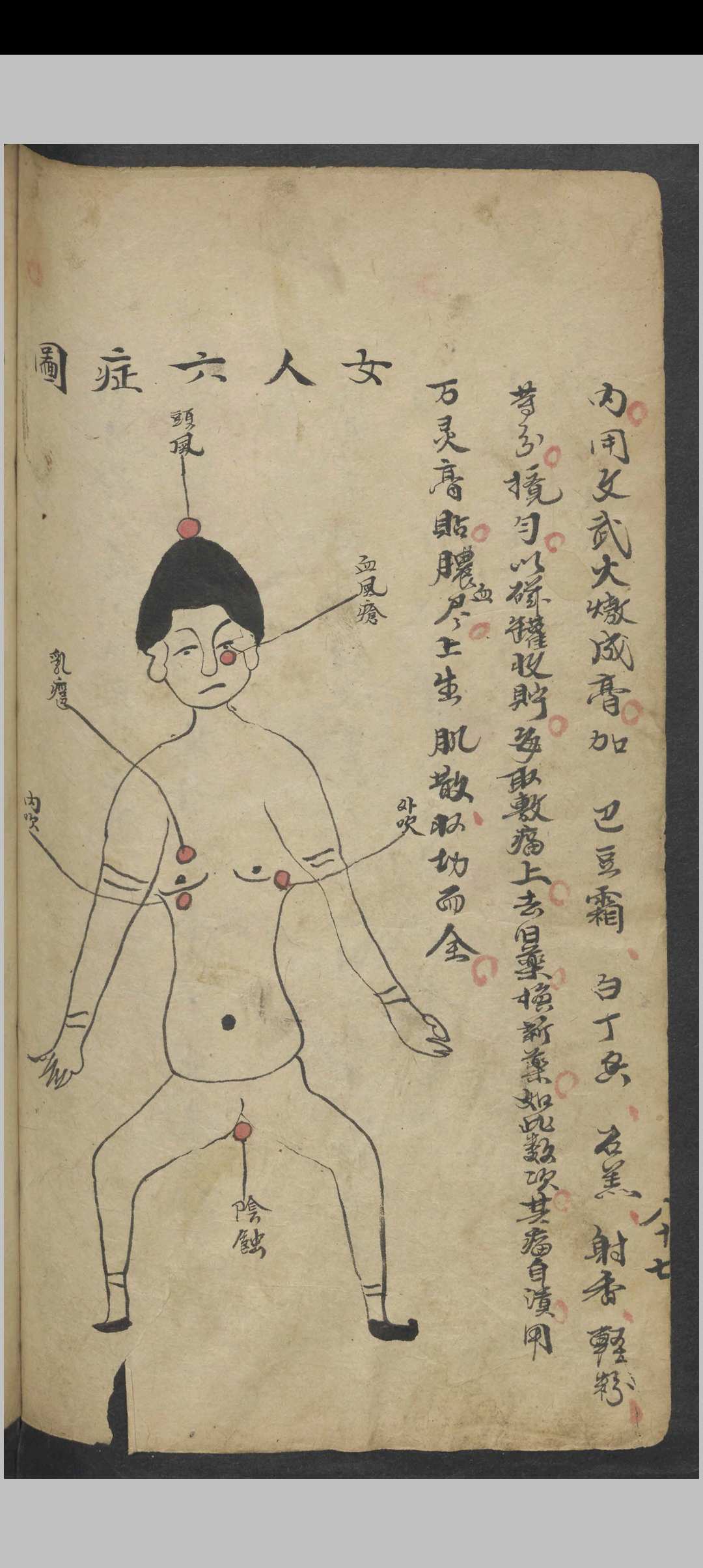 图片[8]-中华古籍网-专注古书收集外科图说及医方    1900-中华古籍网-专注古书收集中华古籍网-专注古书收集