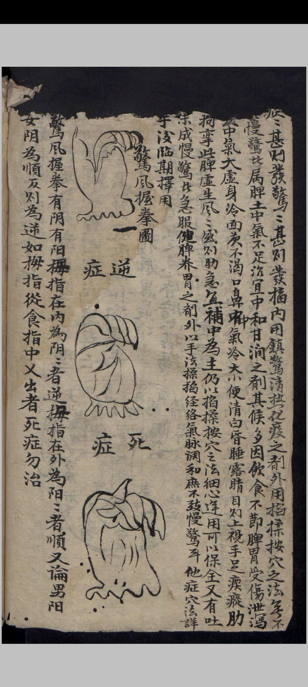 图片[3]-中华古籍网-专注古书收集吴氏家藏推拿法-中华古籍网-专注古书收集中华古籍网-专注古书收集