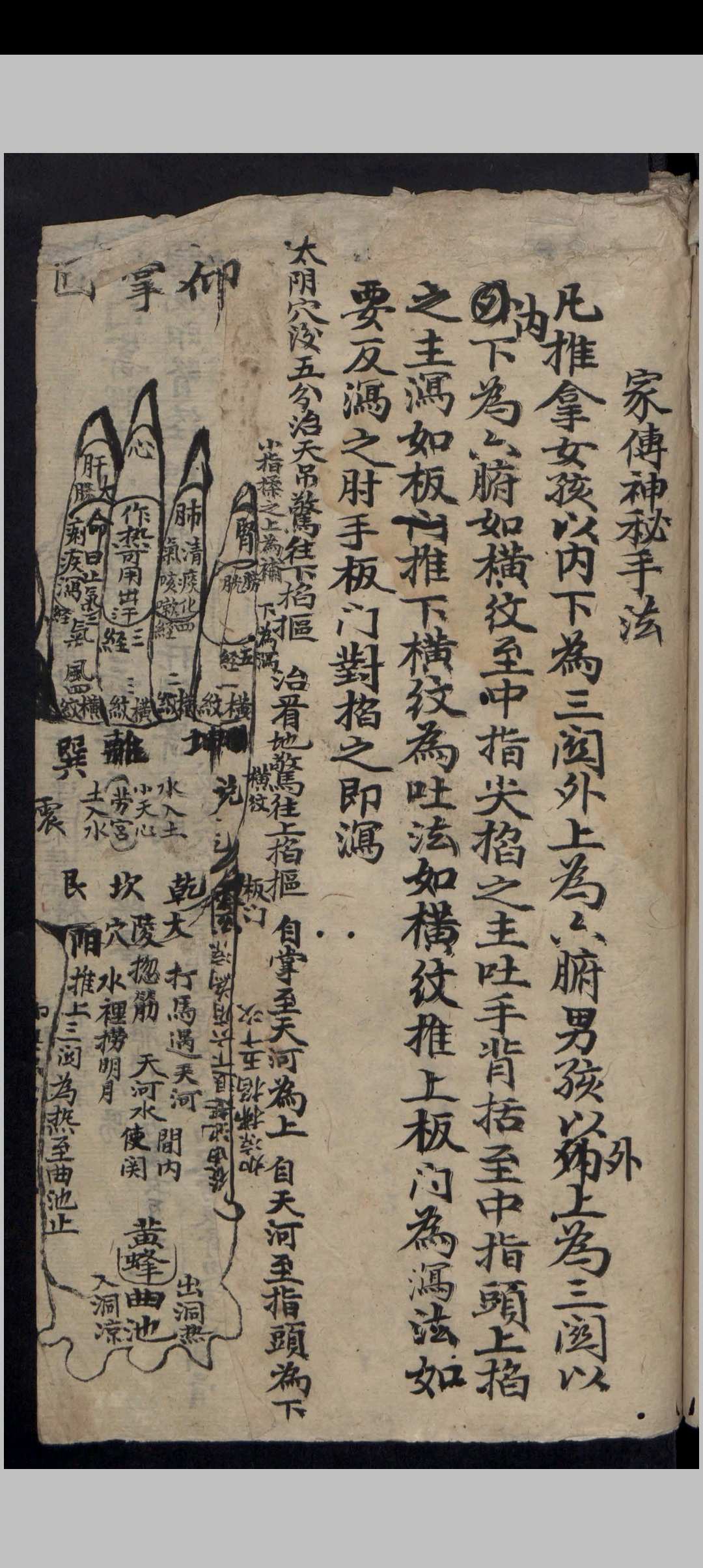 图片[2]-中华古籍网-专注古书收集吴氏家藏推拿法-中华古籍网-专注古书收集中华古籍网-专注古书收集