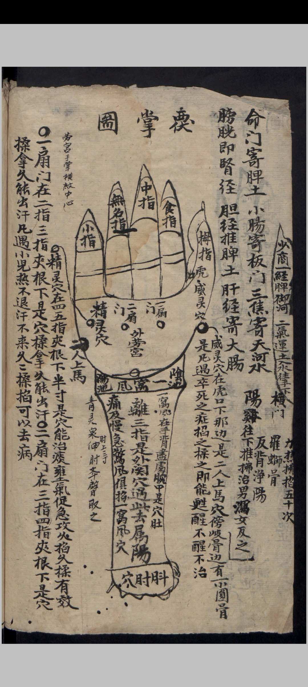 图片[5]-中华古籍网-专注古书收集吴氏家藏推拿法-中华古籍网-专注古书收集中华古籍网-专注古书收集