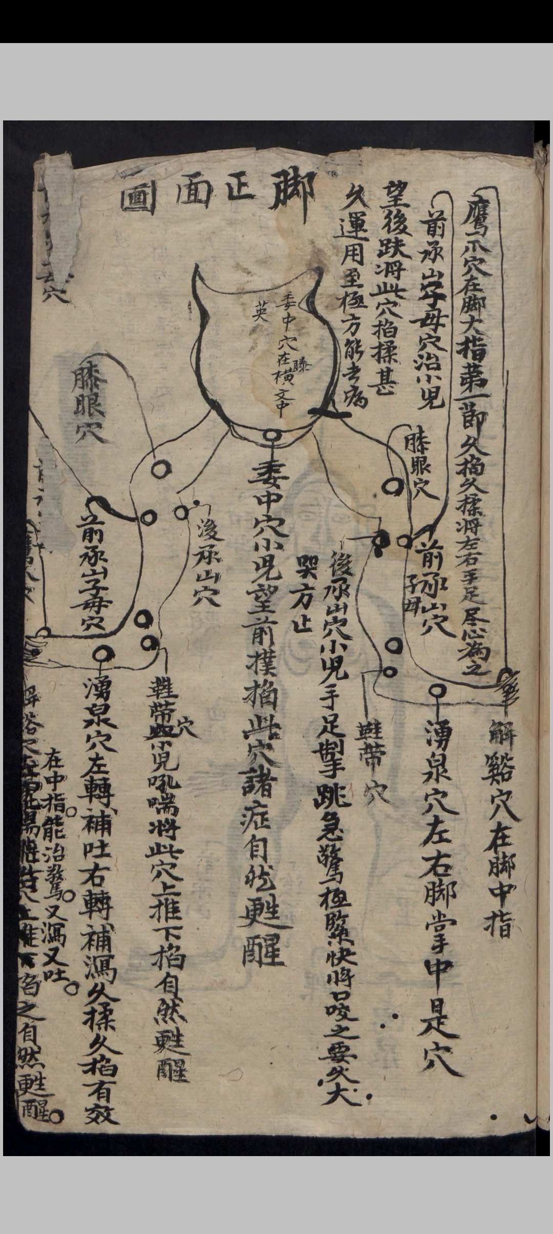 图片[4]-中华古籍网-专注古书收集吴氏家藏推拿法-中华古籍网-专注古书收集中华古籍网-专注古书收集