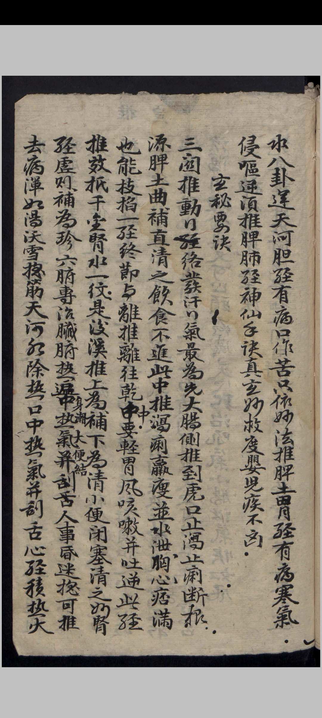 图片[7]-中华古籍网-专注古书收集吴氏家藏推拿法-中华古籍网-专注古书收集中华古籍网-专注古书收集