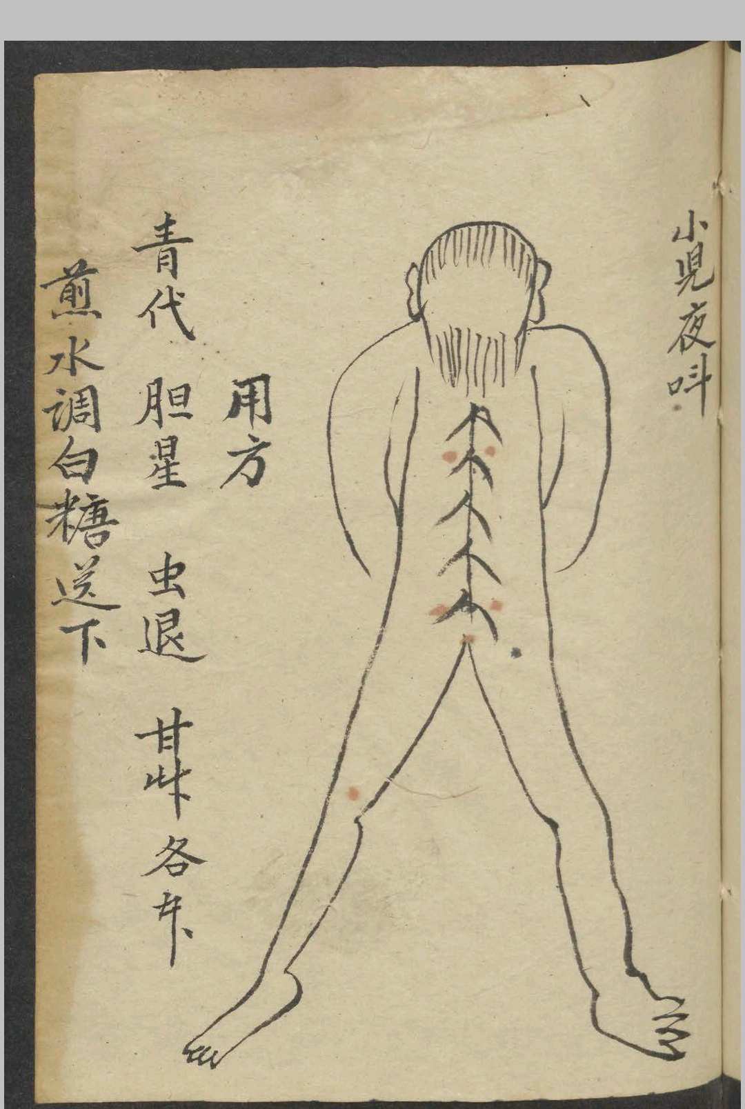 图片[12]-中华古籍网-专注古书收集男妇诸吊便方   1900-中华古籍网-专注古书收集中华古籍网-专注古书收集