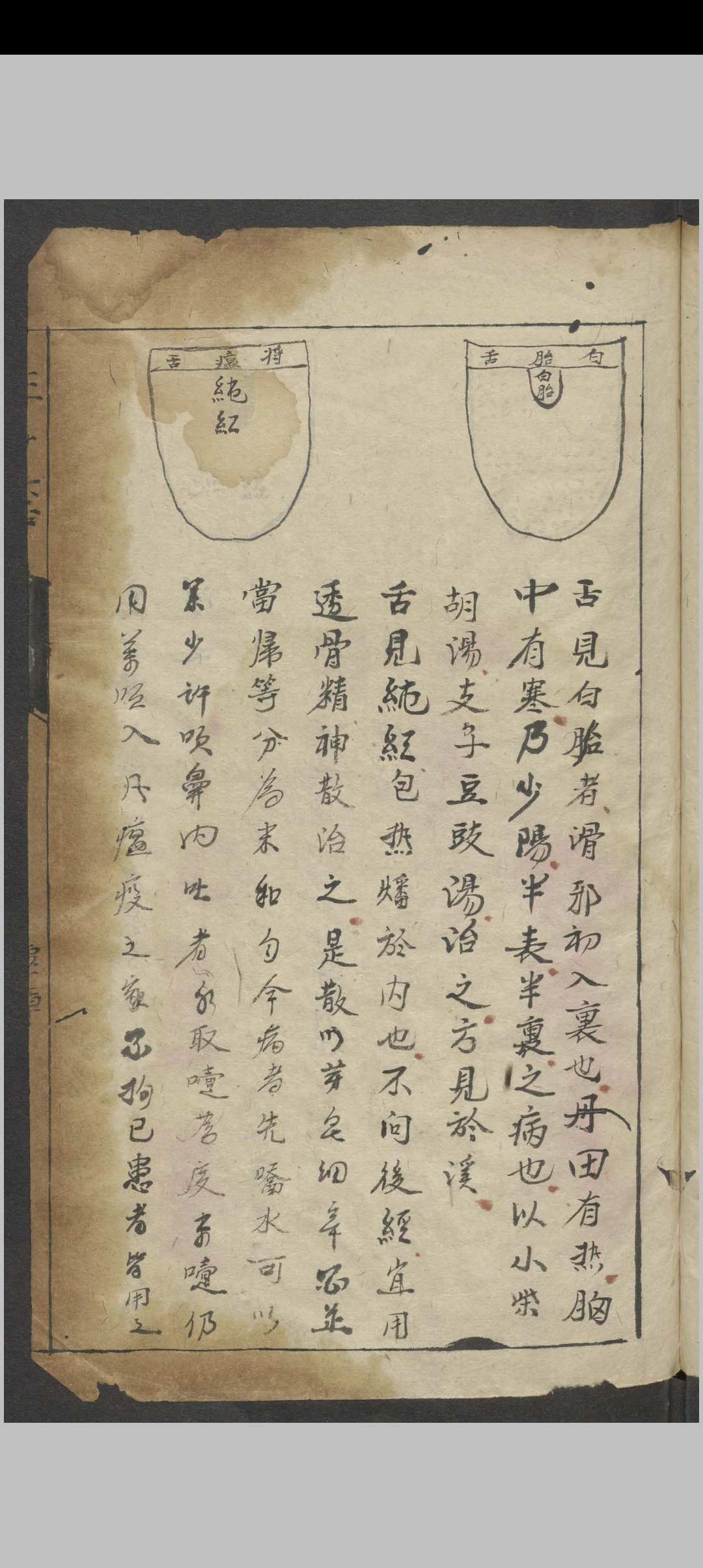图片[3]-中华古籍网-专注古书收集三拾陆舌验症五色杂病方   1932-中华古籍网-专注古书收集中华古籍网-专注古书收集