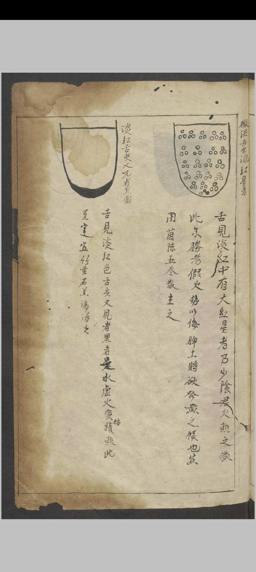 图片[2]-中华古籍网-专注古书收集三拾陆舌验症五色杂病方   1932-中华古籍网-专注古书收集中华古籍网-专注古书收集