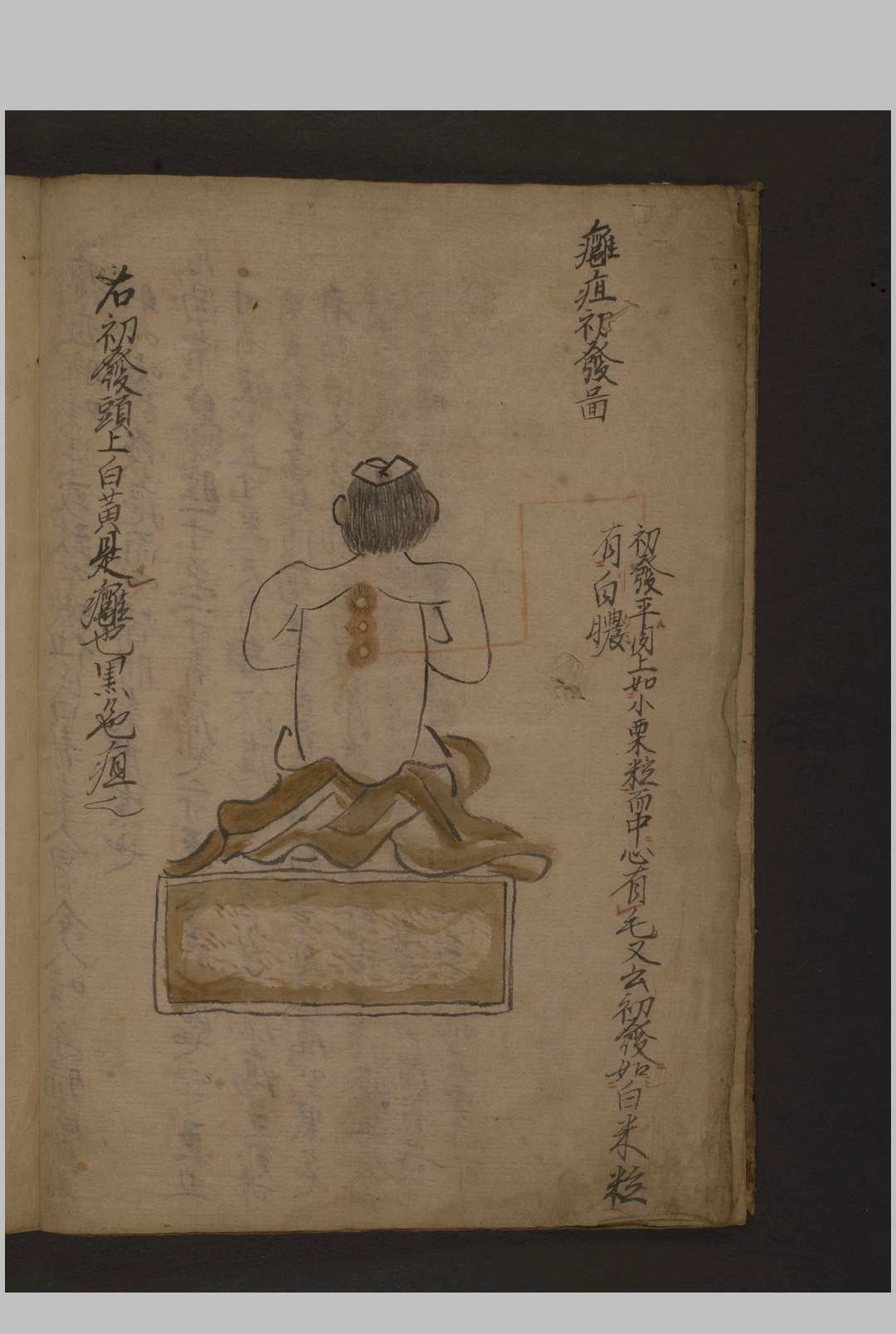 图片[6]-中华古籍网-专注古书收集瘤痘图说 彩色抄本 1600年-中华古籍网-专注古书收集中华古籍网-专注古书收集
