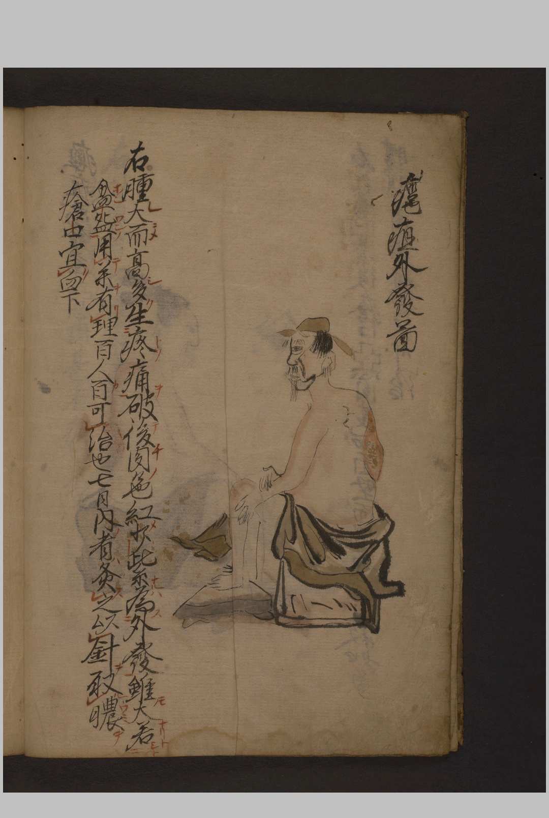 图片[5]-中华古籍网-专注古书收集瘤痘图说 彩色抄本 1600年-中华古籍网-专注古书收集中华古籍网-专注古书收集