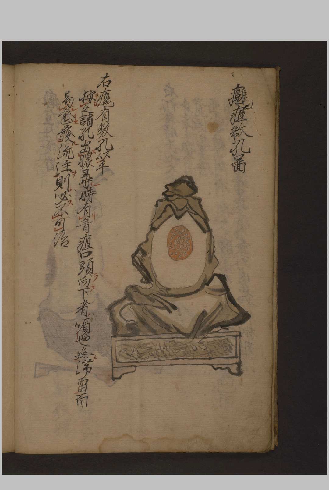 图片[4]-中华古籍网-专注古书收集瘤痘图说 彩色抄本 1600年-中华古籍网-专注古书收集中华古籍网-专注古书收集