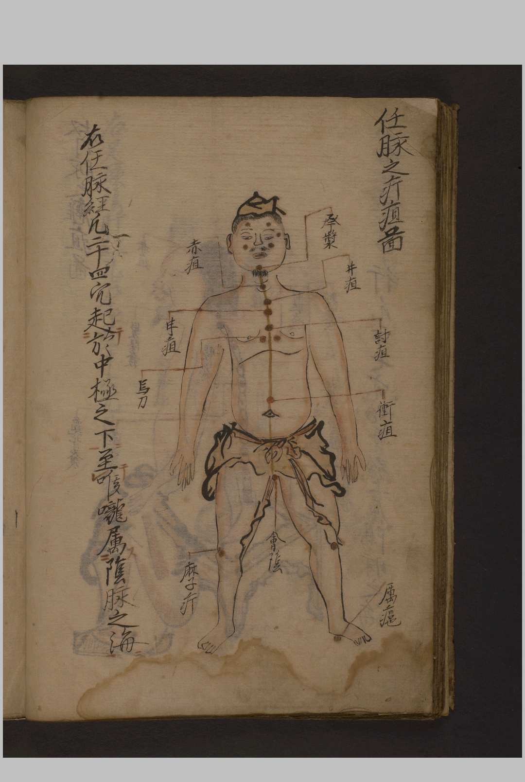 图片[3]-中华古籍网-专注古书收集瘤痘图说 彩色抄本 1600年-中华古籍网-专注古书收集中华古籍网-专注古书收集