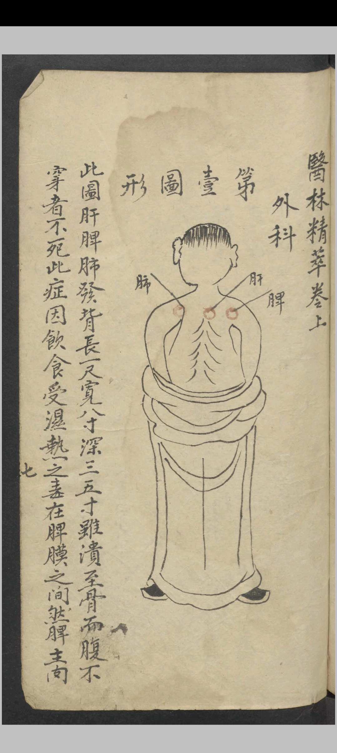 图片[4]-中华古籍网-专注古书收集医林精萃   1900-中华古籍网-专注古书收集中华古籍网-专注古书收集