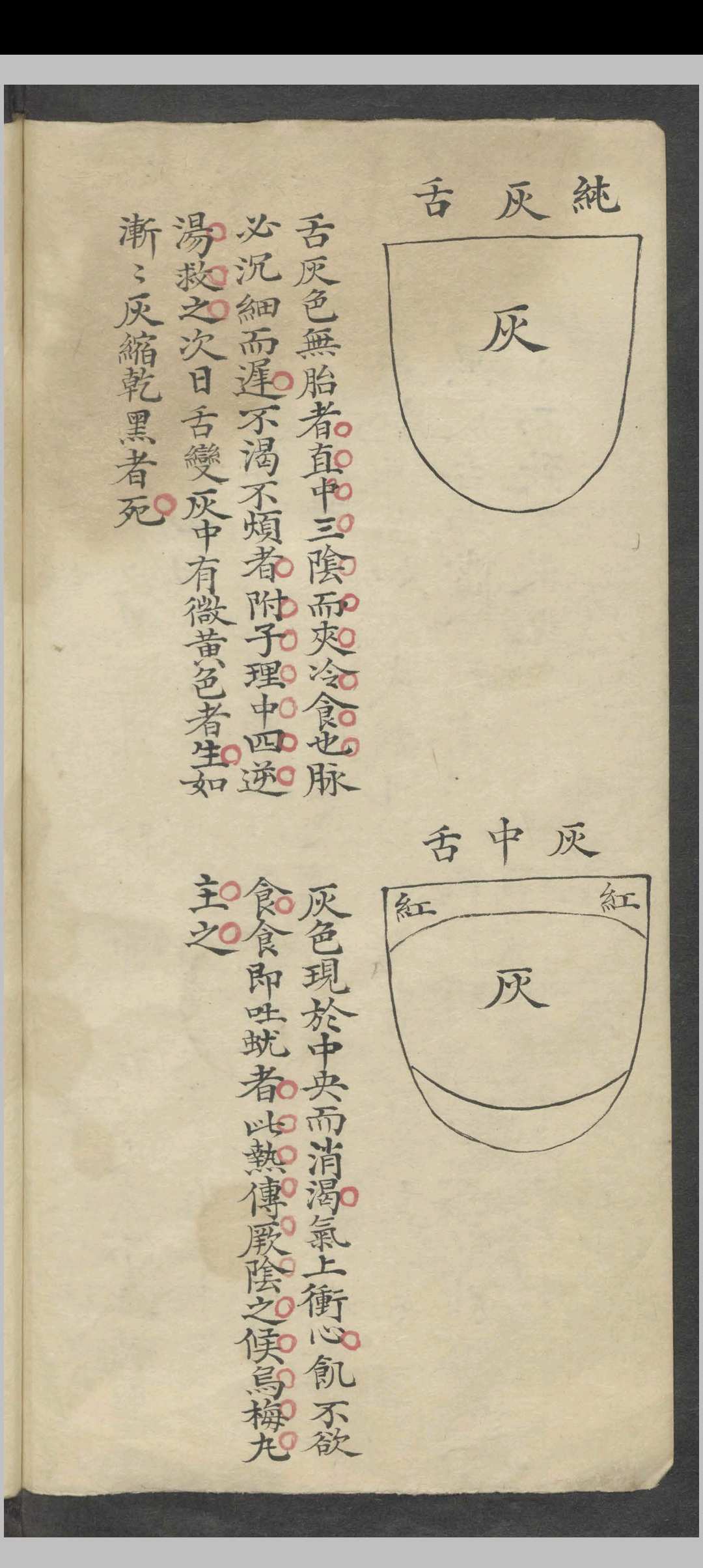 图片[3]-中华古籍网-专注古书收集舌胎总论   1900-中华古籍网-专注古书收集中华古籍网-专注古书收集