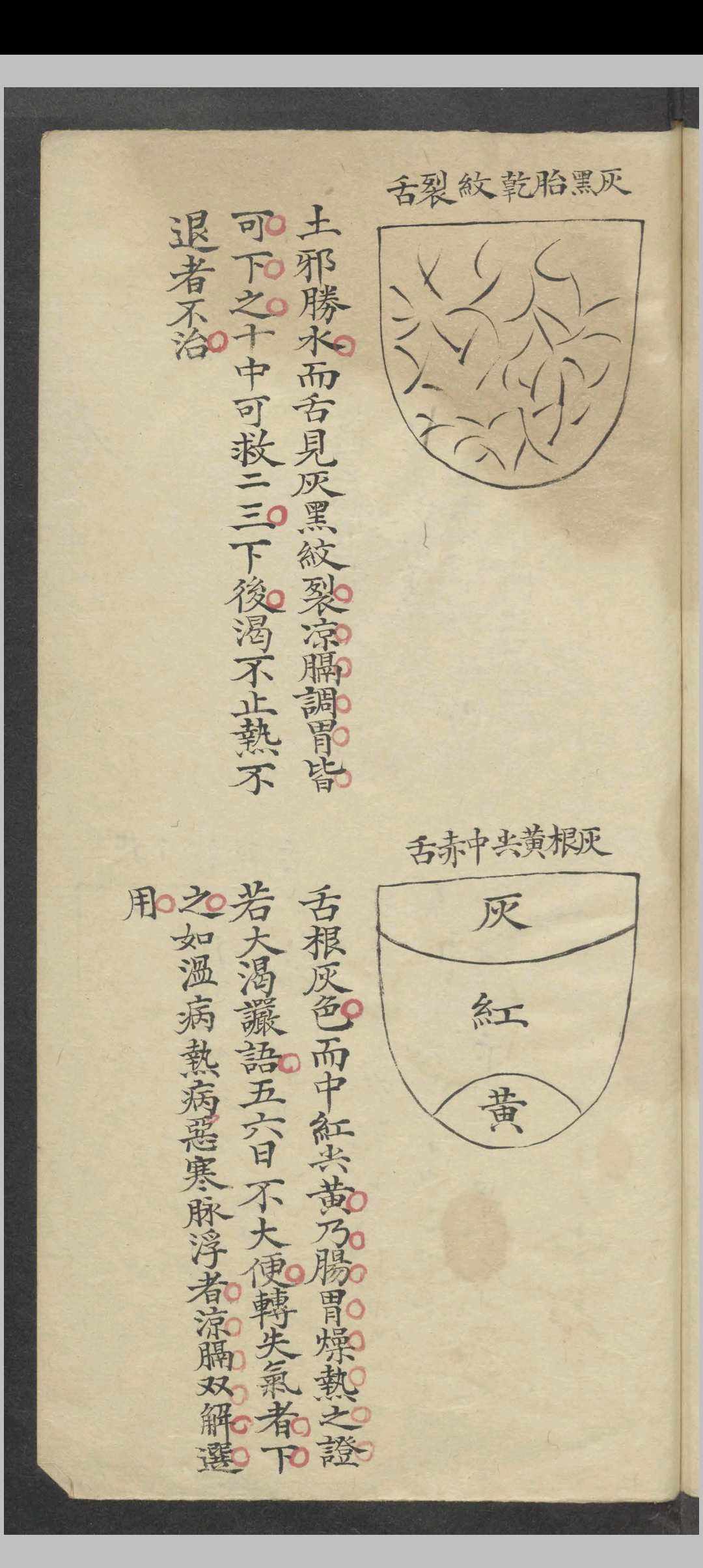 图片[5]-中华古籍网-专注古书收集舌胎总论   1900-中华古籍网-专注古书收集中华古籍网-专注古书收集